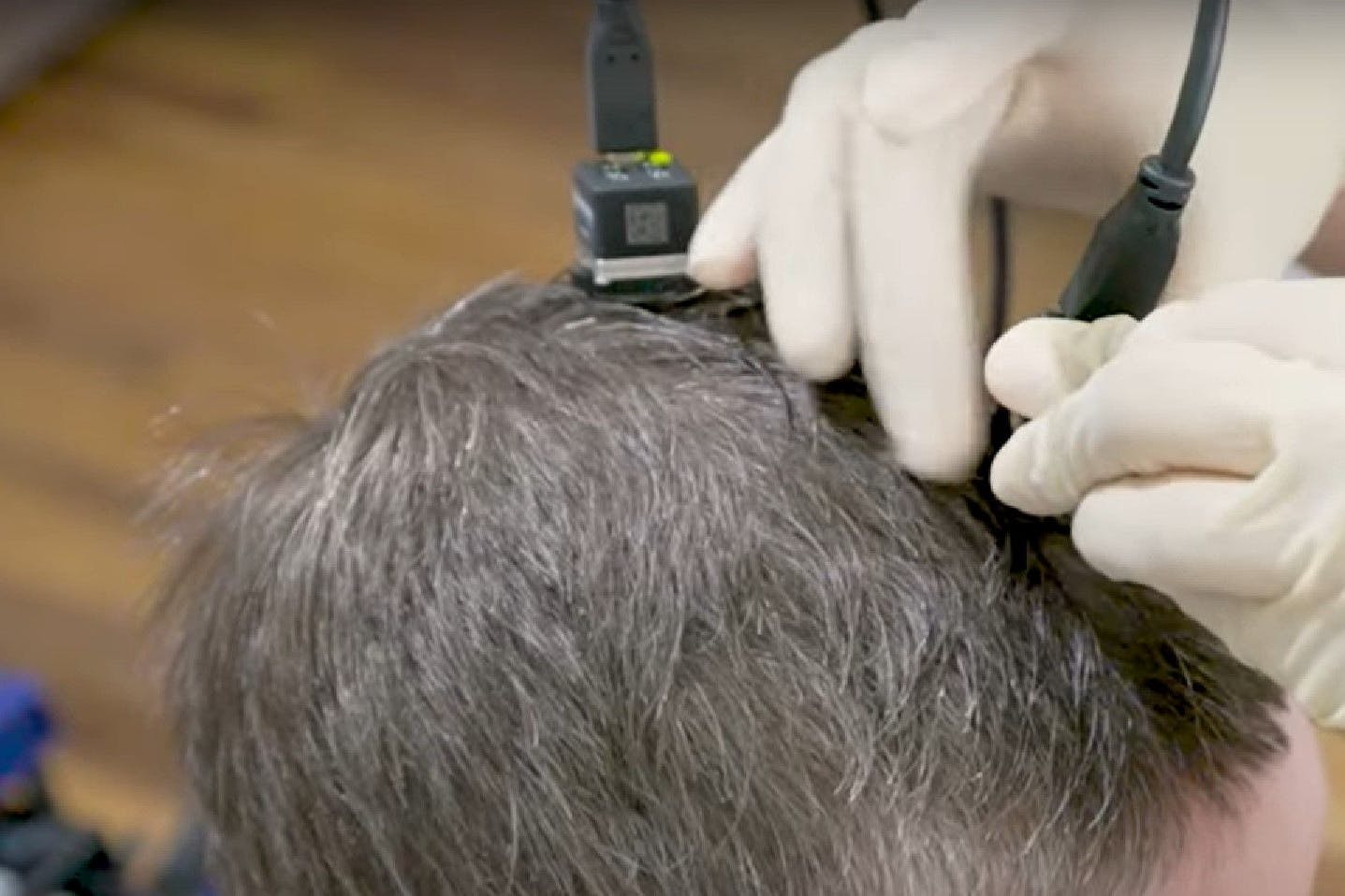 Schnittstelle Gehirn: Mithilfe eines Gehirnchips soll die ALS-Patientin Pat Bennett wieder sprechen können.