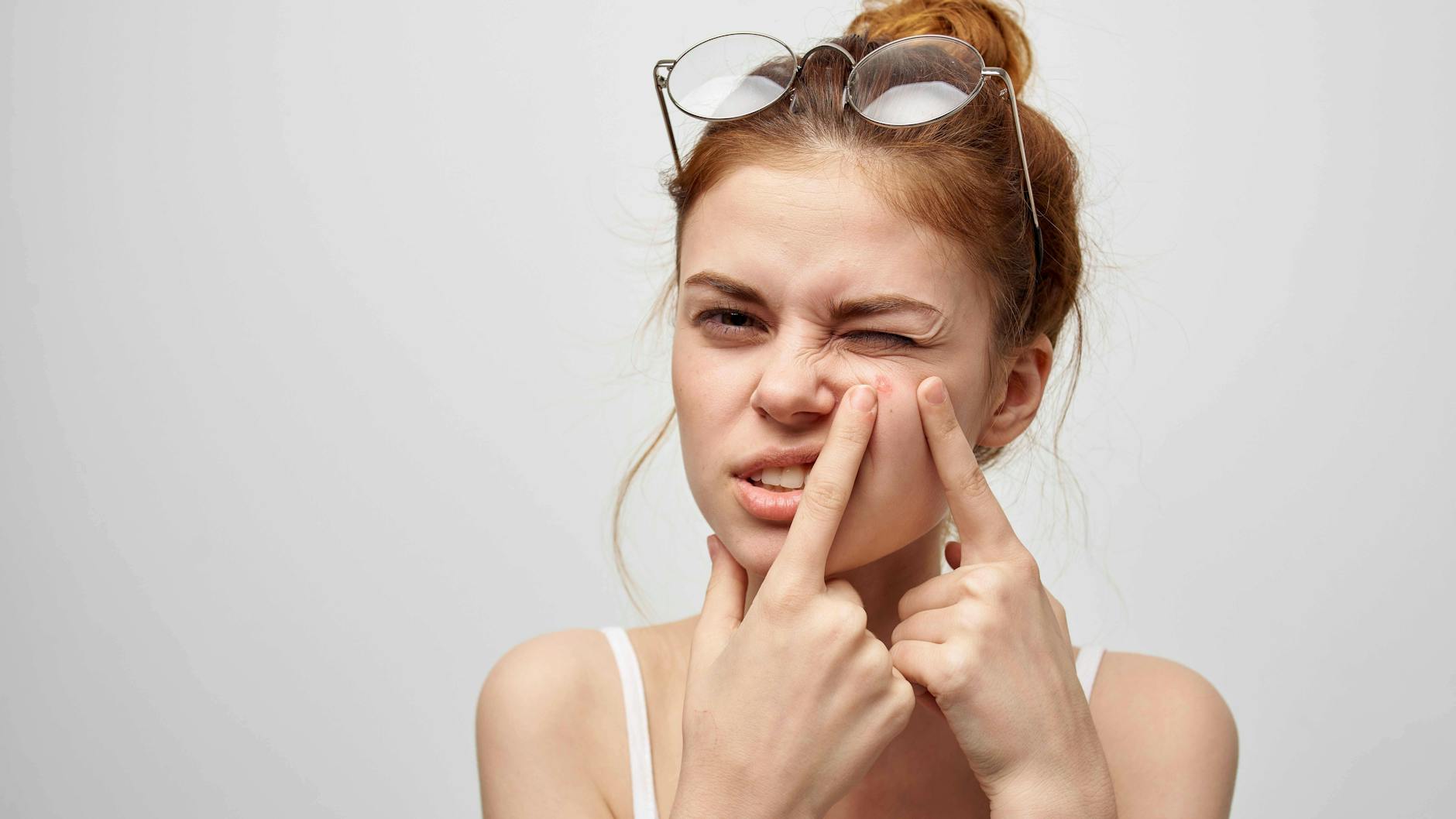 Pickel auszudrücken, ist meist keine so gute Idee.