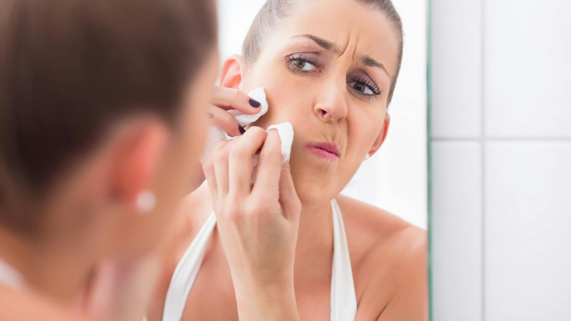 Wer Pickel unbedingt ausdrücken will, sollte besonders auf die Hygiene dabei achten.