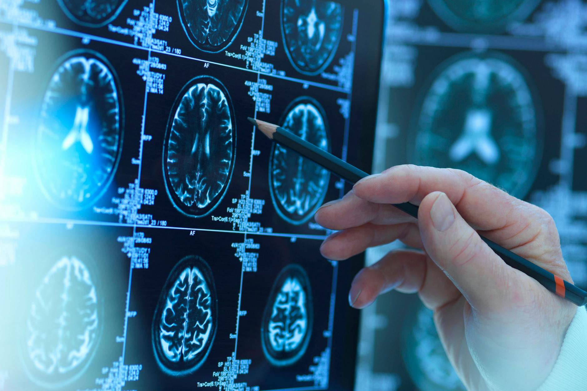 Eine Langzeitstudie der Universität von Chicago fand jetzt heraus, dass ein verminderter Geruchssinn ein Vorbote für Altersdemenz sein kann.