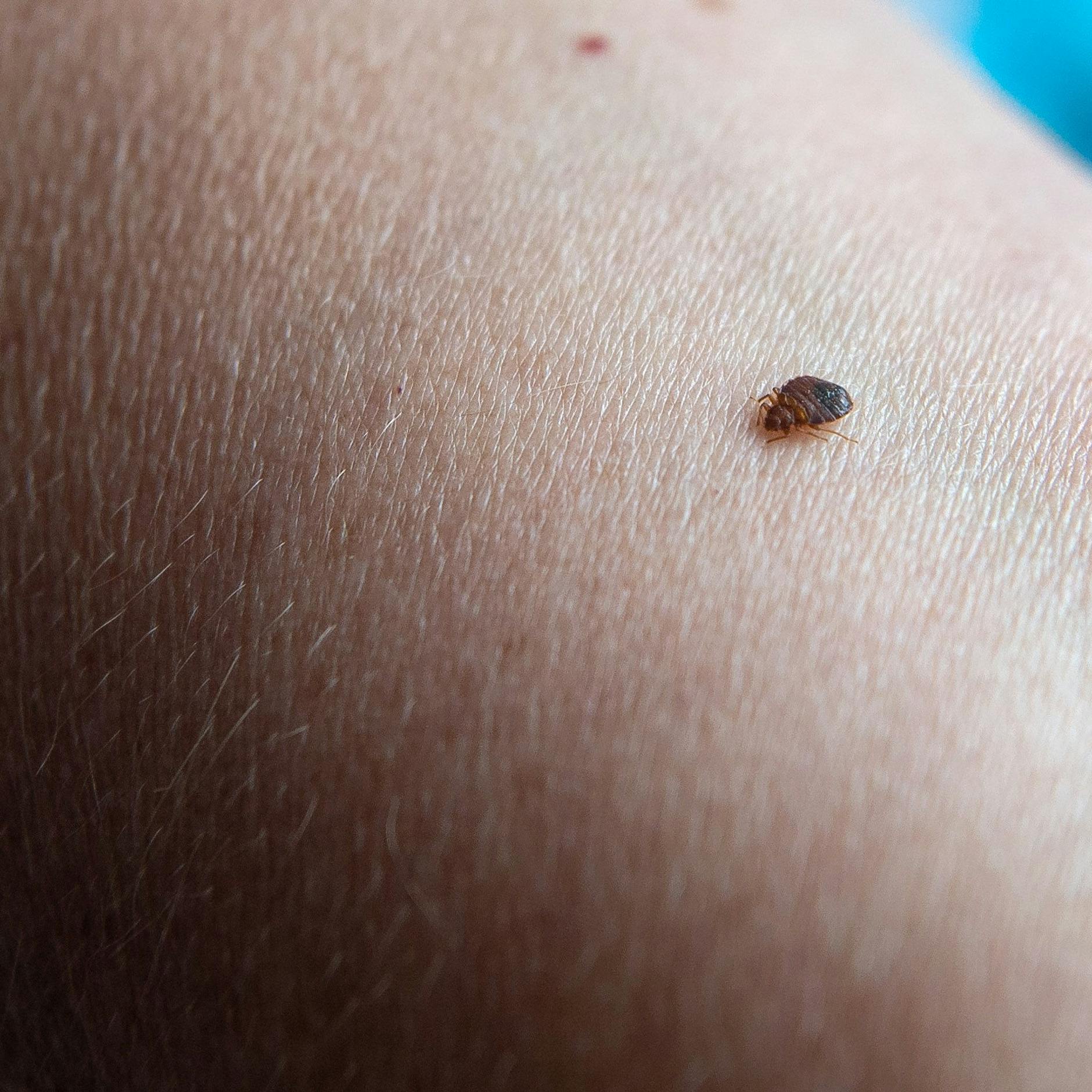 Ekel-Alarm in Kinos und Zügen: Kommt die Bettwanzen-Plage auch zu uns?