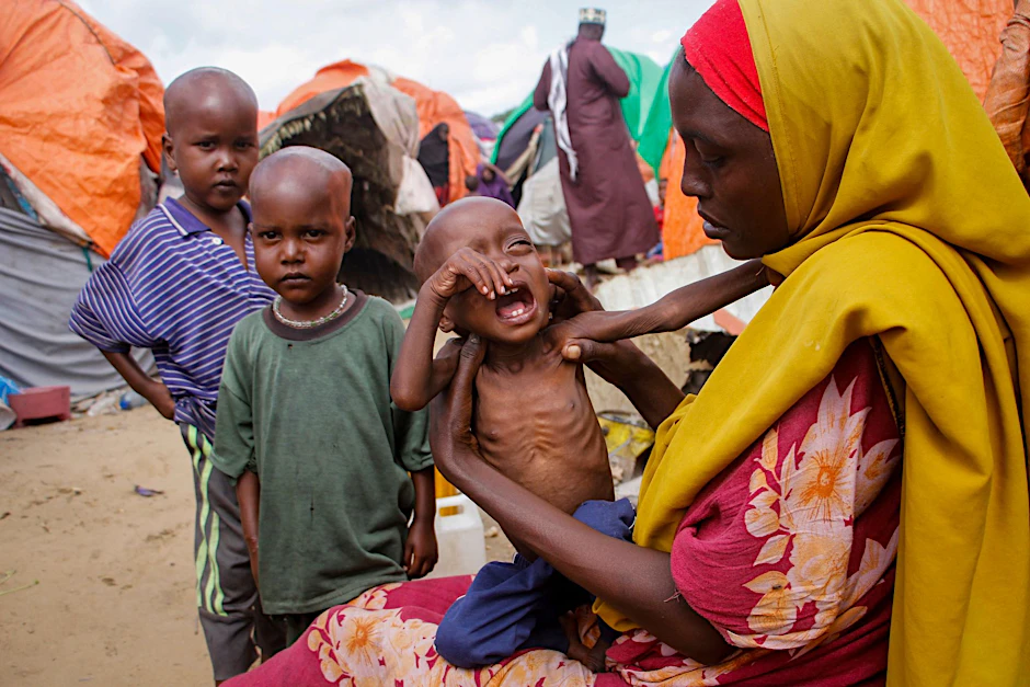 ARCHIV - Eine Mutter, die aus der von Dürre heimgesuchten Region Lower Shabelle geflohen ist, hält ihre unterernährte Tochter in einem Lager für Vertriebene.  