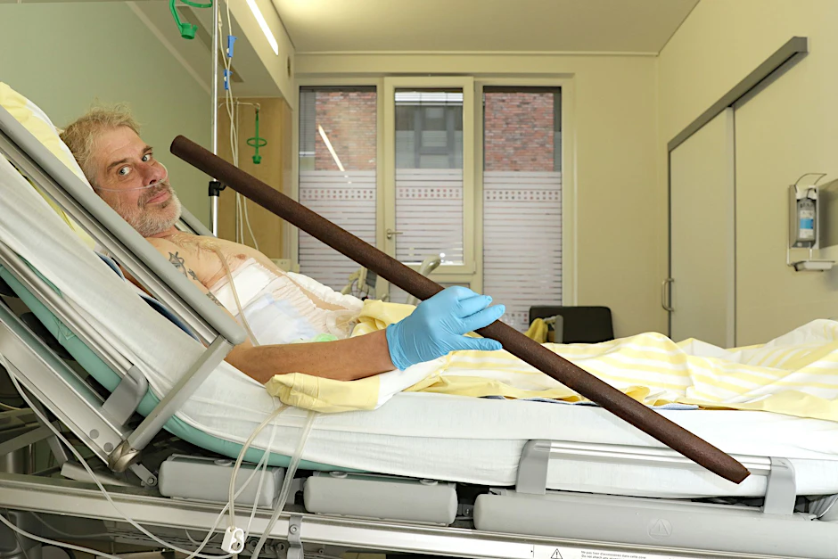 HANDOUT - Patient Frank Vaorin liegt im Krankenhausbett und hält die Zaunstange in der Hand, die seinen Körper durchbohrte.  linikverbund Bremen/dpa
