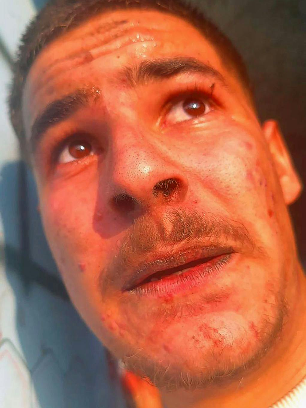 Die Angst ist ihm ins Gesicht geschrieben: Noam Cohen (19).