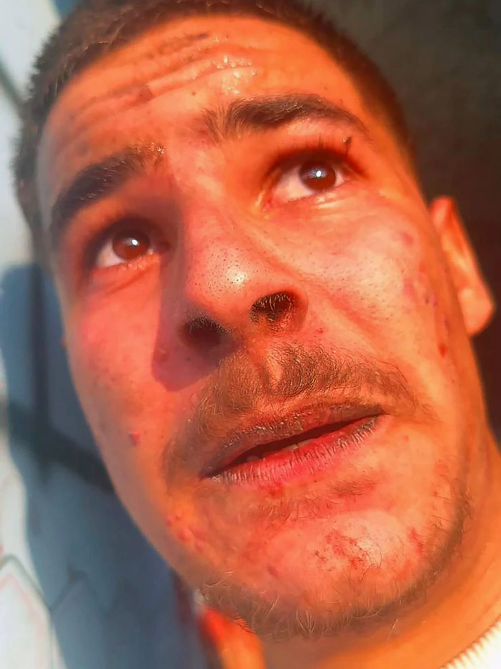 Die Angst ist ihm ins Gesicht geschrieben: Noam Cohen (19).