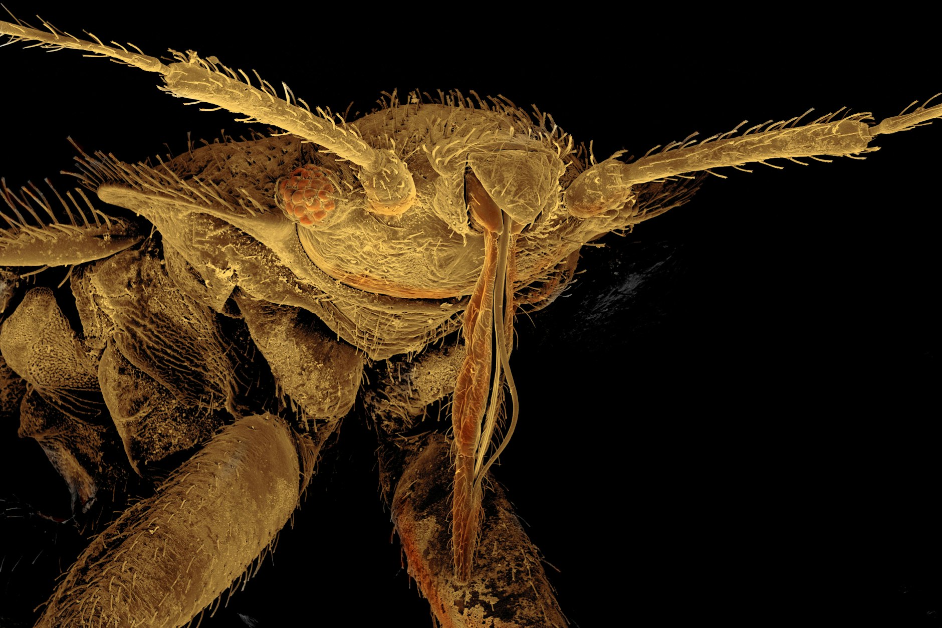 Eine Bettwanze, stark vergrößert: Wer sie in seinem Bett hat, möchte sie schnell wieder loswerden.