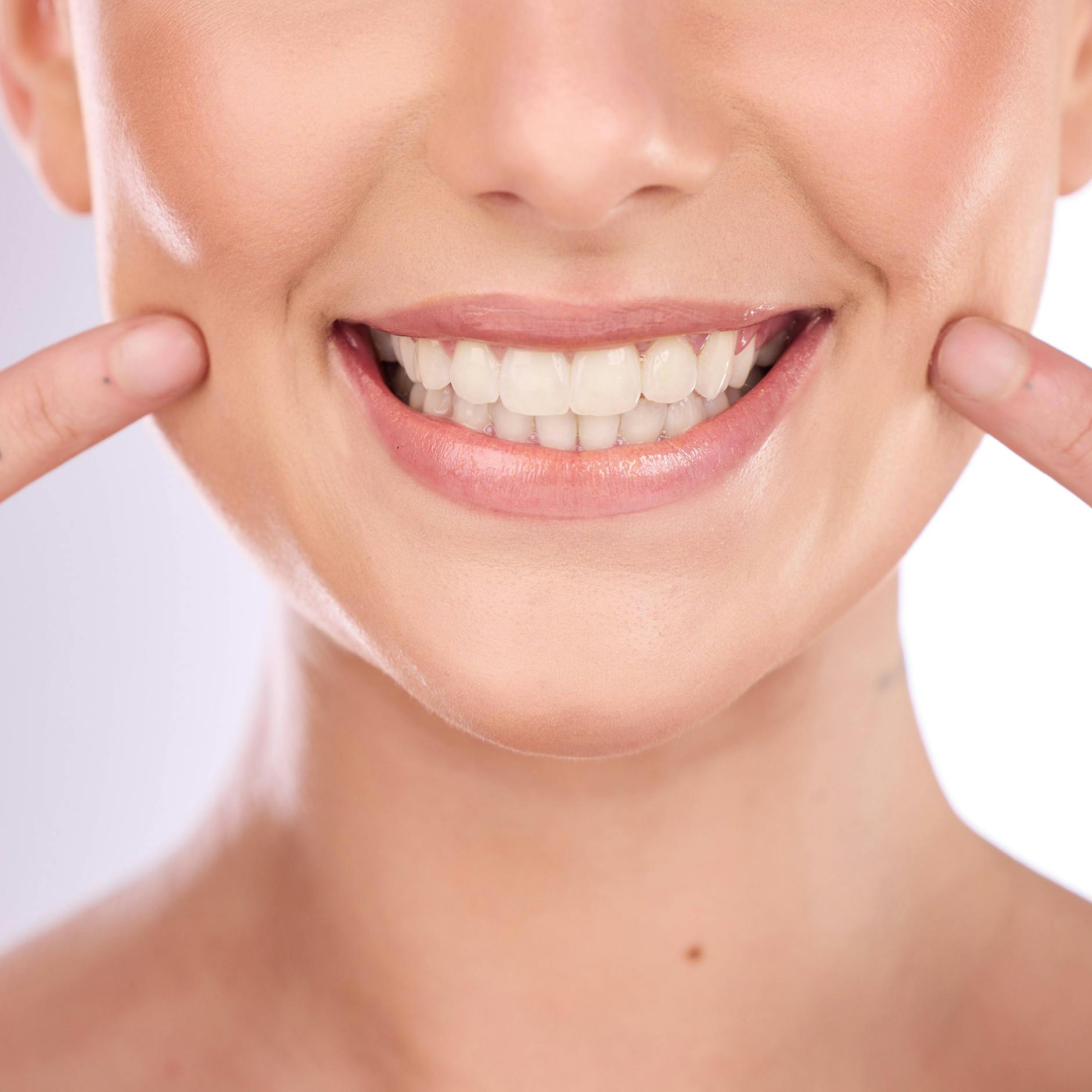 Professionelle Zahnreinigung: Diese Krankenkassen übernehmen die Kosten