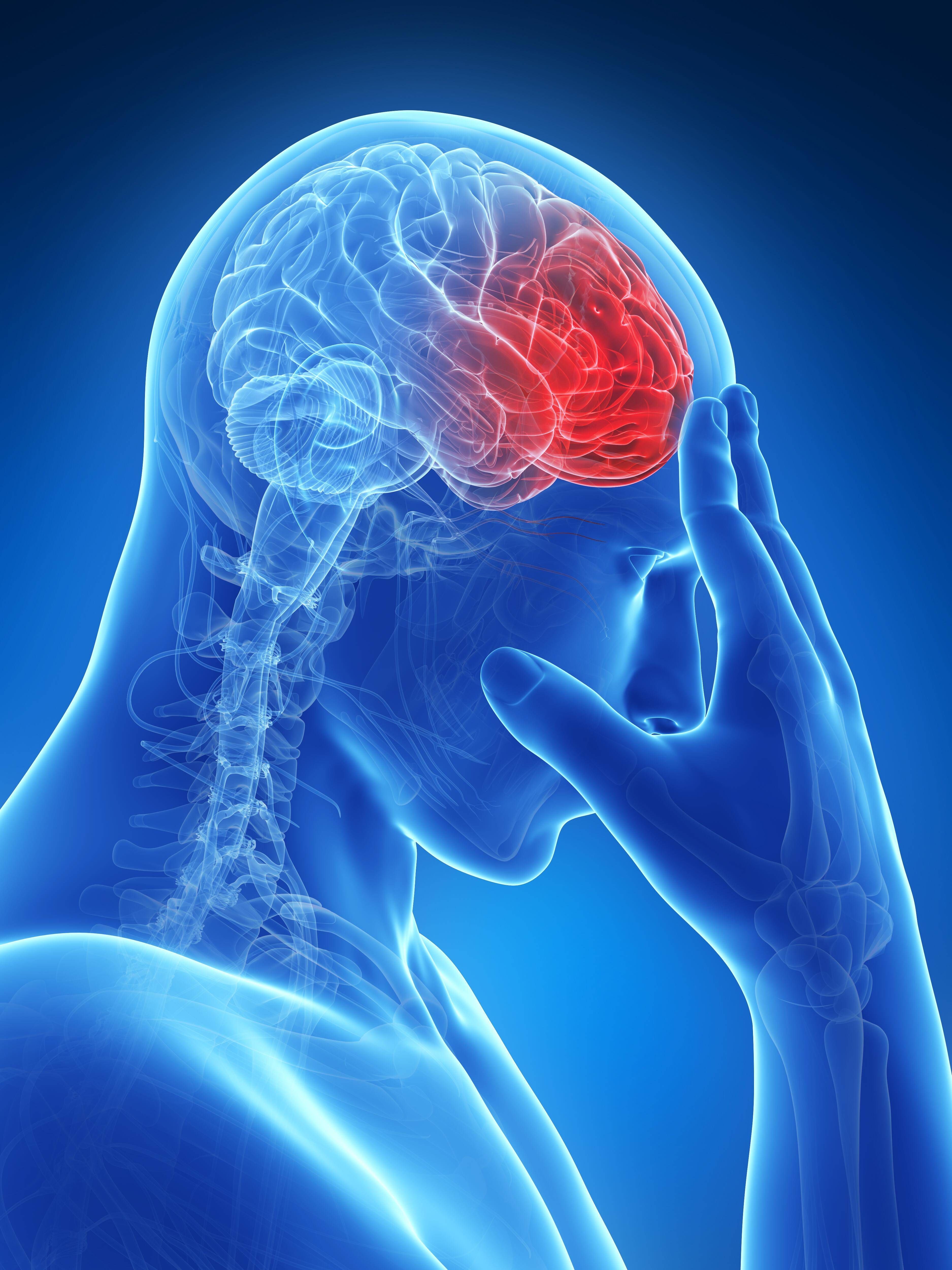 Schlaganfall vermeiden: DIESE 14 Lebensmittel können schützen