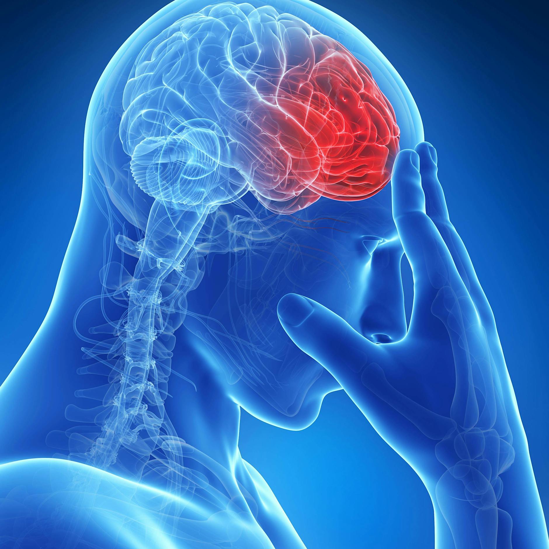 Schlaganfall vermeiden: DIESE 14 Lebensmittel können schützen