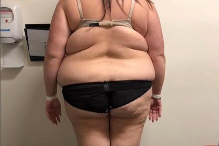 So sah Jessica vorher aus.