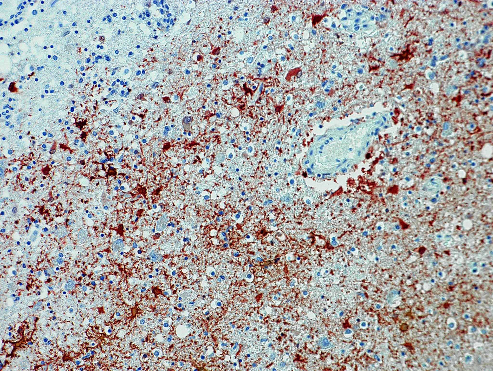 Mann in Bayern mit Borna-Virus infiziert: Verläufe meist tödlich