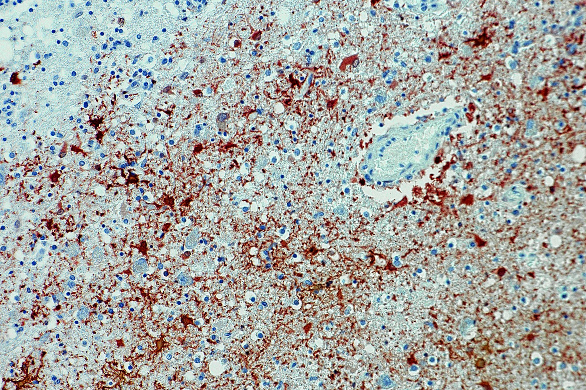 Die Aufnahme zeigt einen Anitkörpernachweis zum Borna-Virus im Gewebe.