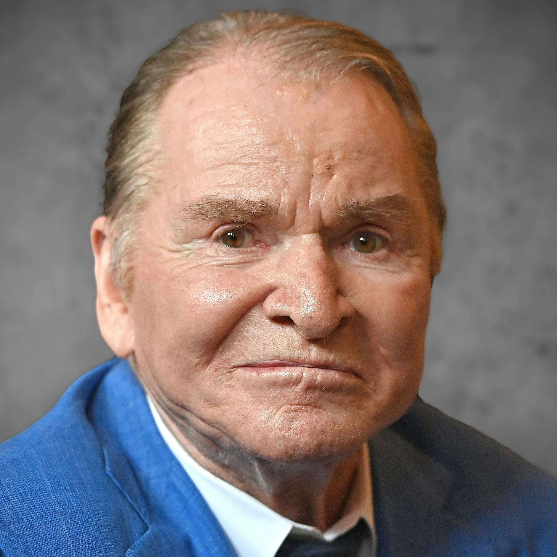 Große Sorge um Fritz Wepper: Blutvergiftung, Intensivstation!