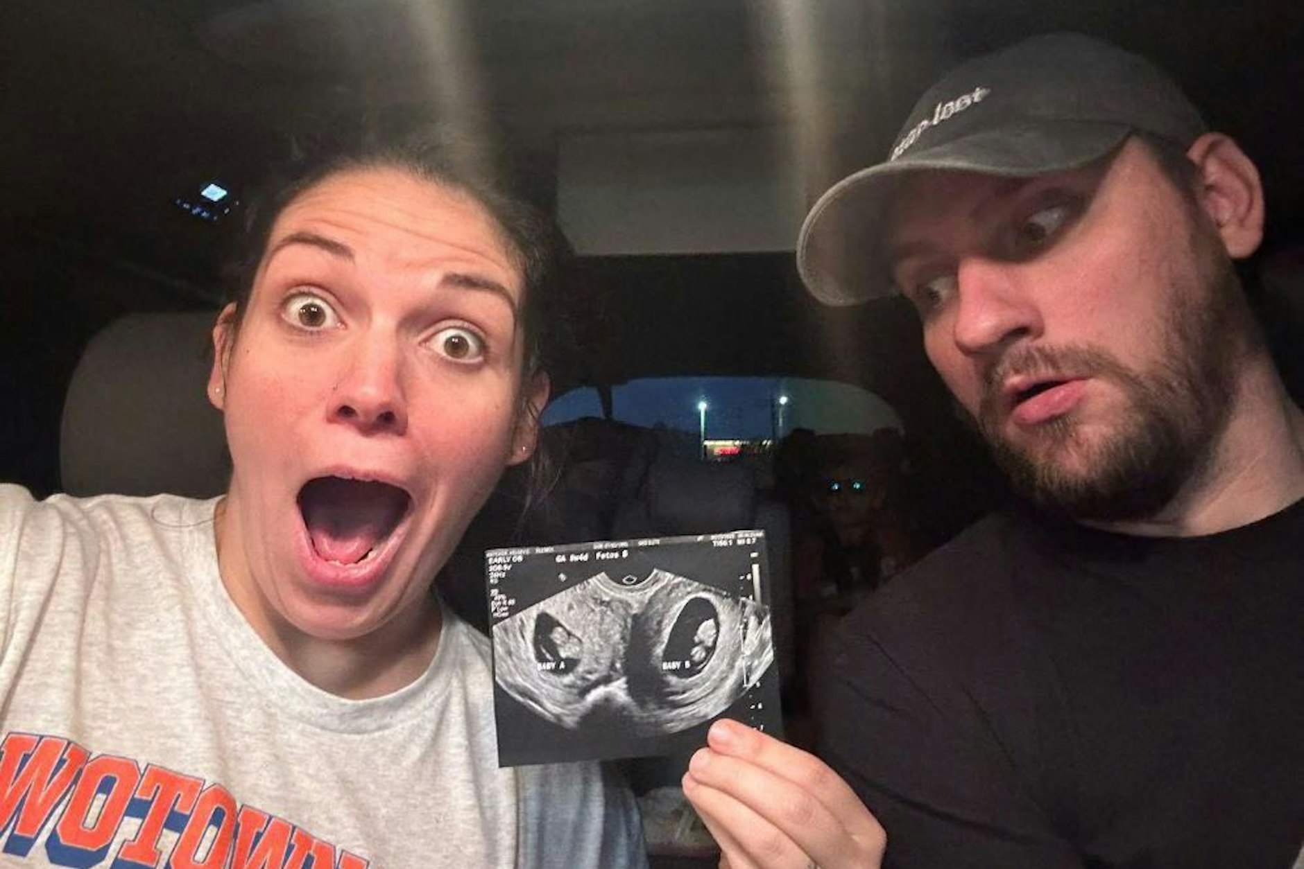 Kelsey Hatcher und ihr Ehemann Caleb Hatcher zeigen im Mai 2023 ein Ultraschallbild ihrer Zwillinge in den zwei Gebärmüttern.&nbsp;&nbsp;