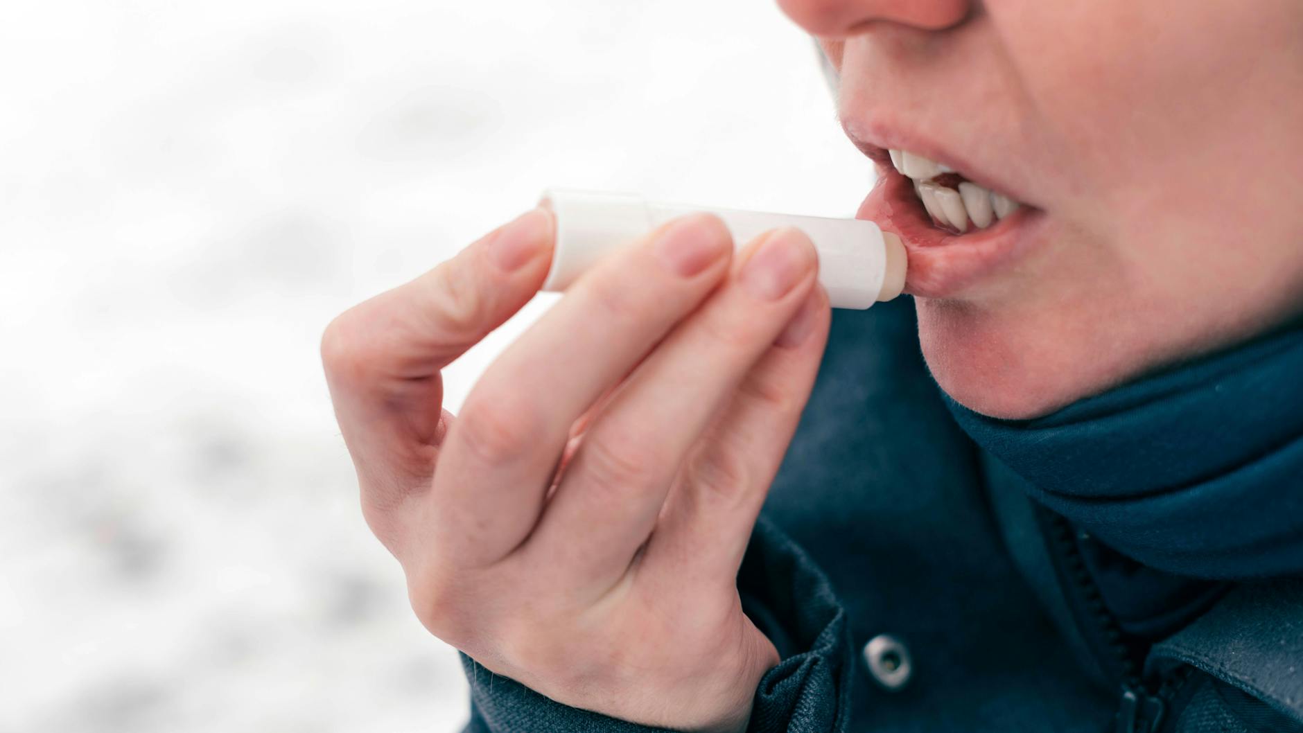 Nicht jeder Lippenpflegestift hilft bei eingerissenen Mundwinkeln.