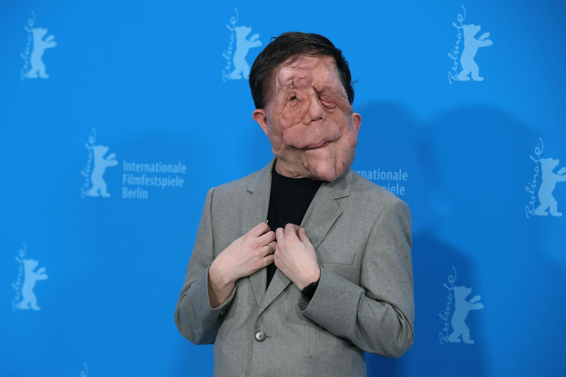 Der britische Schauspieler Adam Pearson auf der 74. Berlinale in Berlin