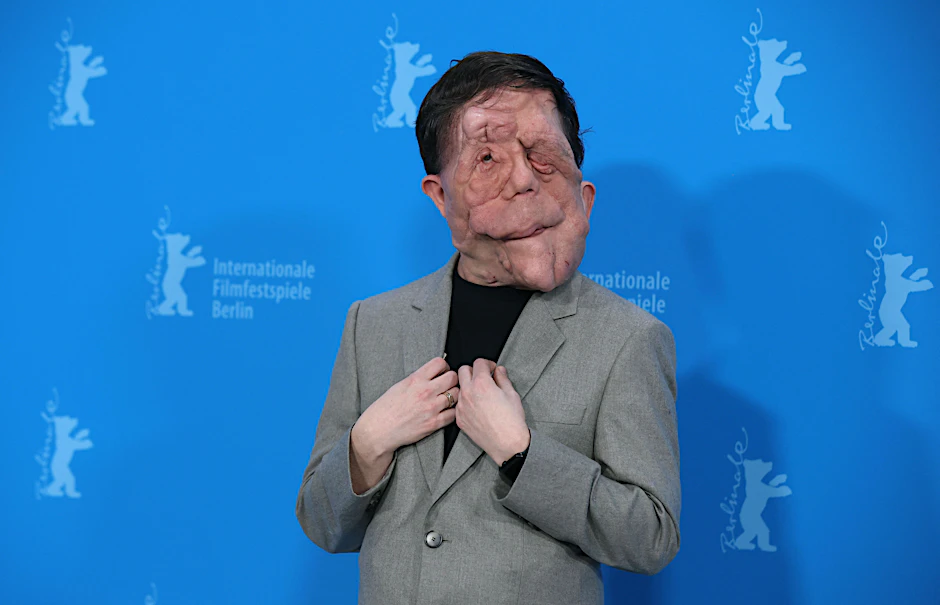 Der britische Schauspieler Adam Pearson auf der 74. Berlinale in Berlin