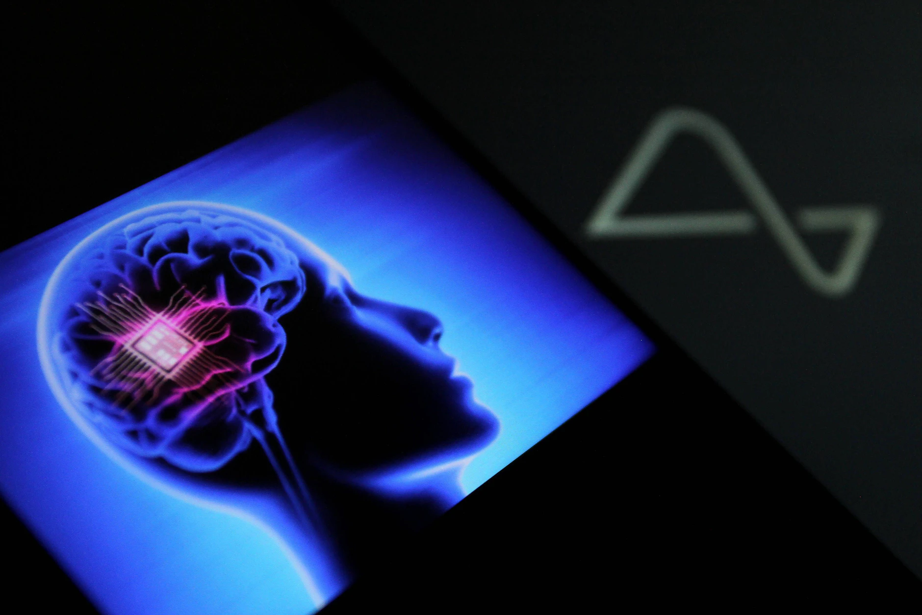 Elon Musk: Patient mit Neuralink-Chip im Hirn kann Computermaus steuern