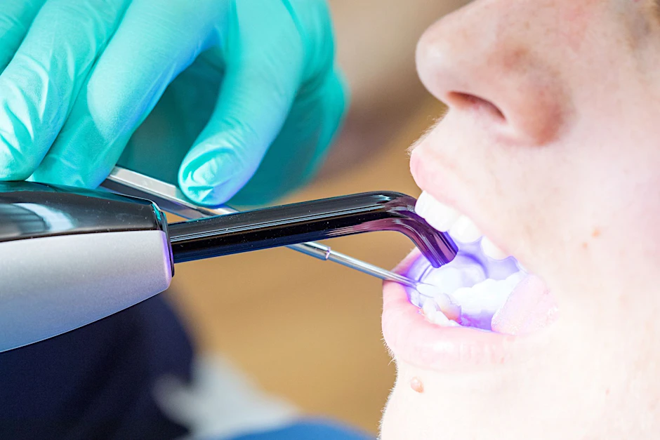 ARCHIV - Laut KZBV-Vorstandschef Hendges gehen bei fachgerechtem Einsatz von Dentalamalgam keine Gesundheitsgefahren aus.  