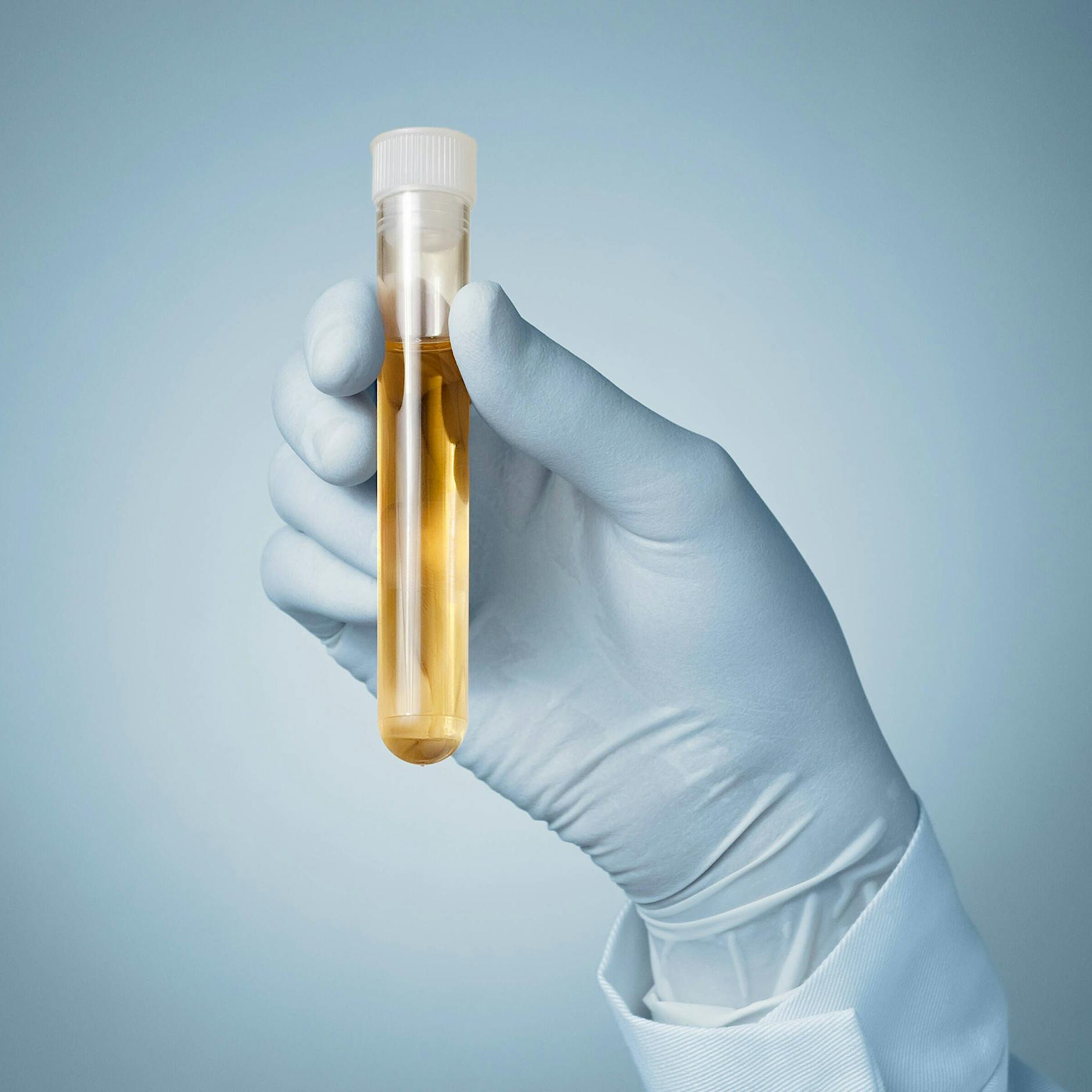 Erste gesetzliche Krankenkasse zahlt Urintest zur Krebs-Prävention