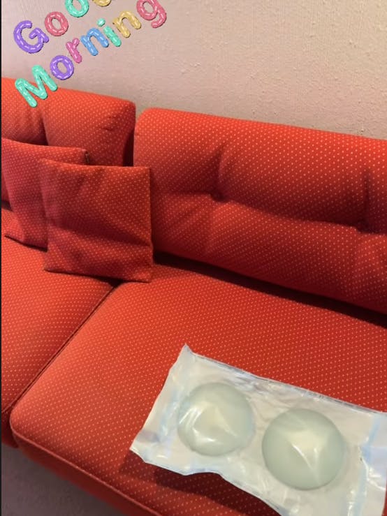 Iris Klein zeigt auf Instagram die Silikonkissen, die sie sich entfernen lassen hat.