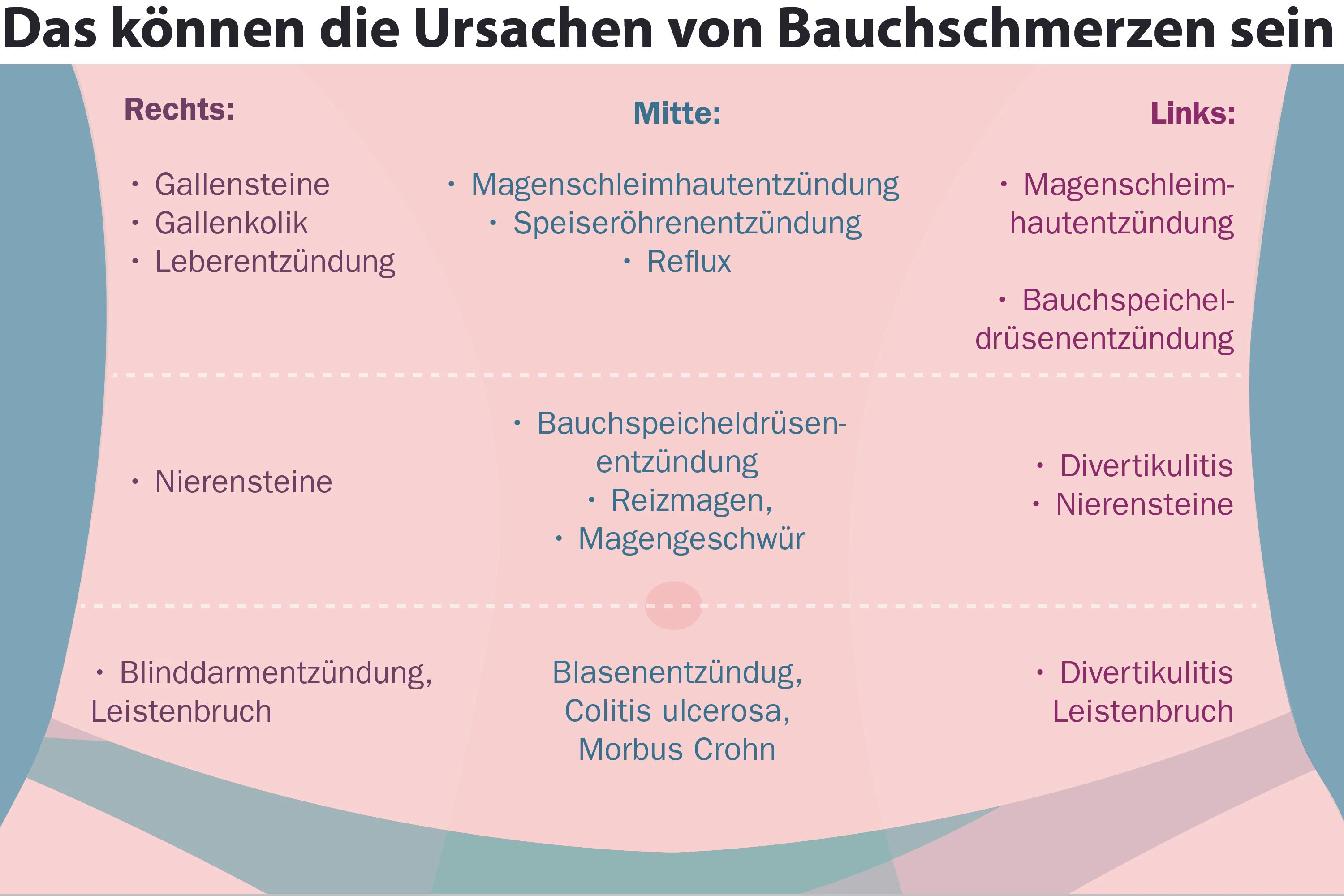 Die Grafik zeigt, welche Ursachen für Bauchschmerzen – je nach Lokalisation – infrage kommen.