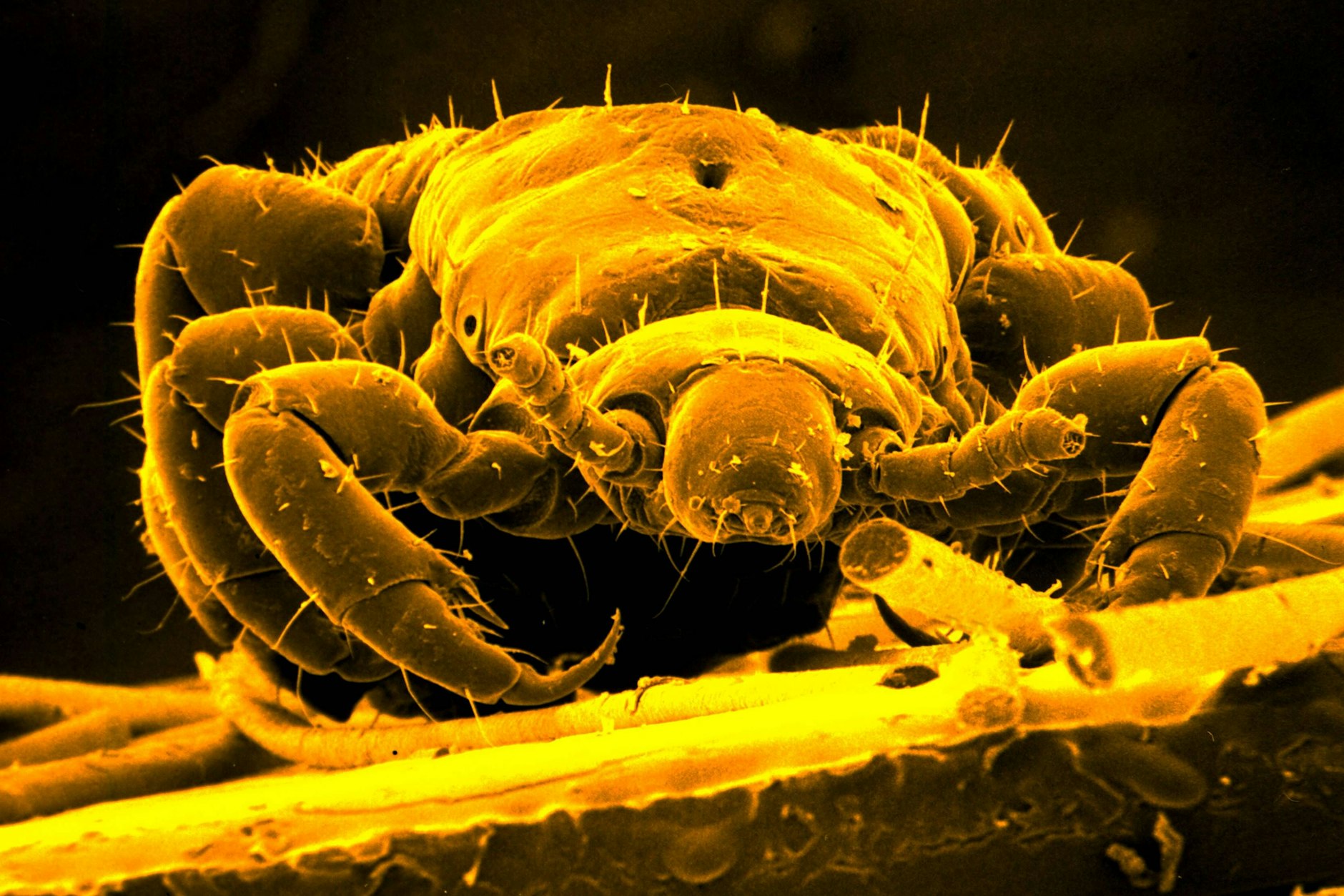 Eine Kopflaus unter dem Mikroskop - die kleinen Parasiten befallen nicht nur Kinder, sondern können sich bei allen Menschen einnisten.