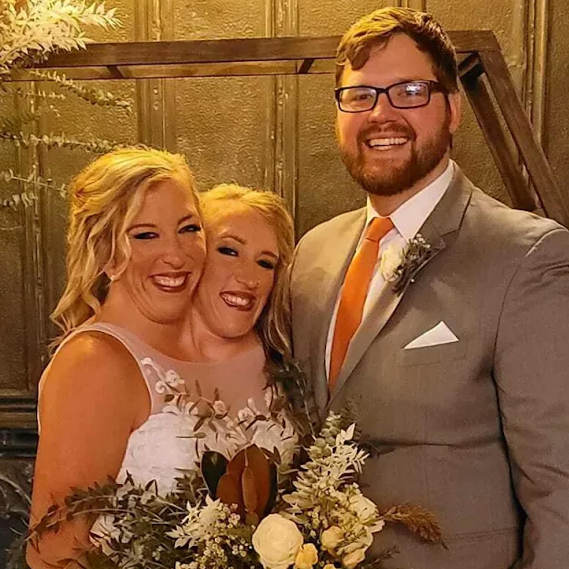 Siamesische Zwillinge haben geheiratet! Wie funktioniert das mit dem Sex?