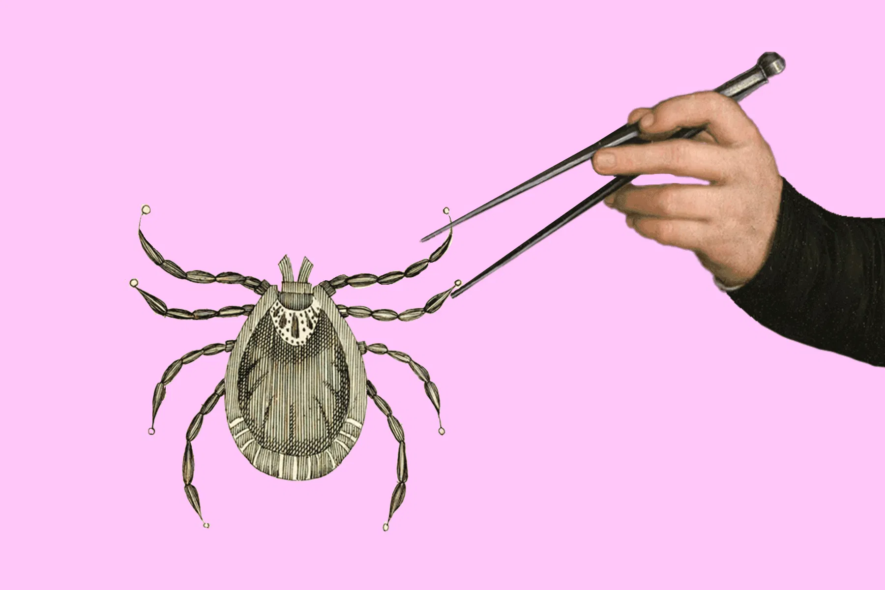 Ob mit Pinzette oder anderen Werkzeugen: Zecken sollten möglichst schnell entfernt werden.