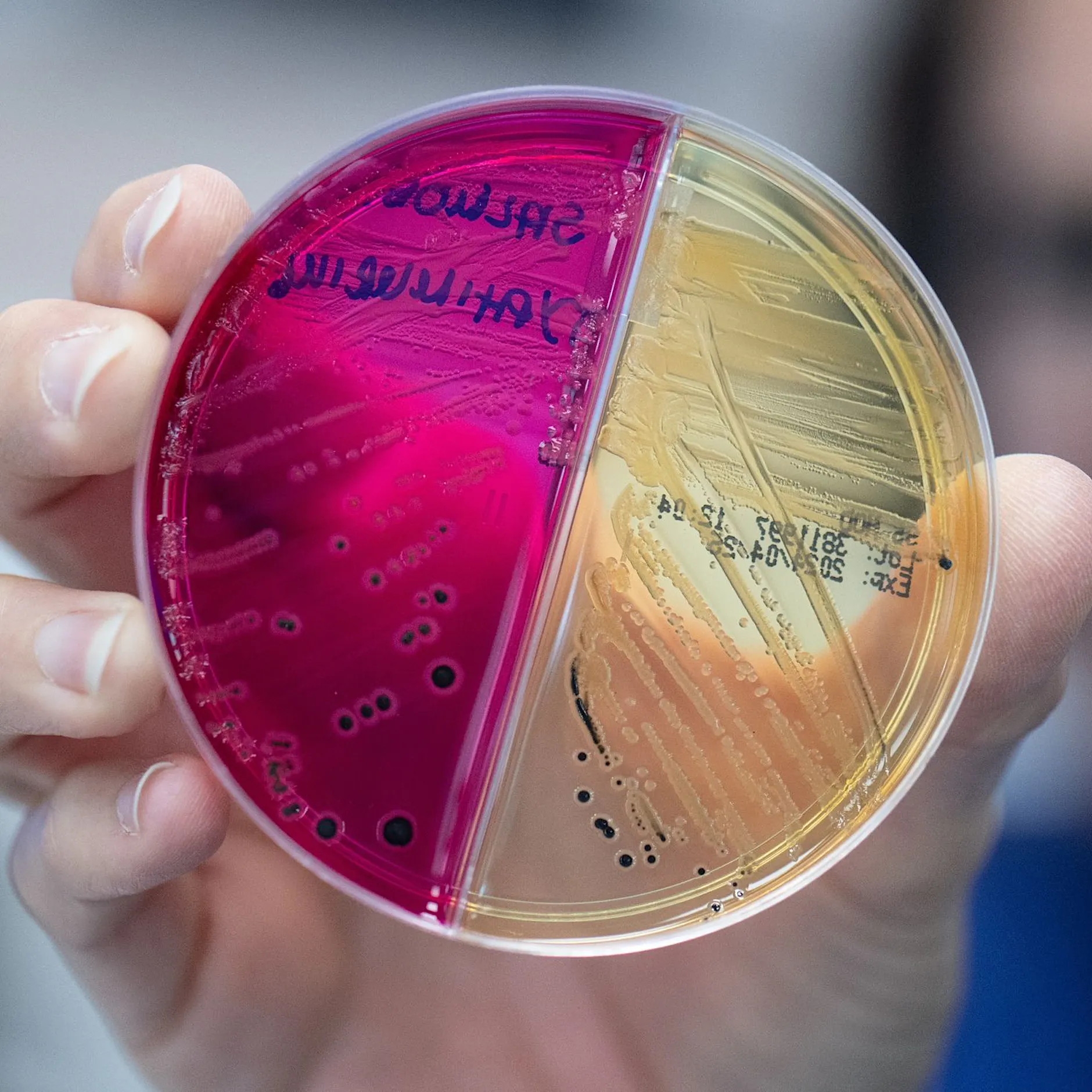 Detektivarbeit am Darm-Mikrobiom: Was Stuhlproben verraten