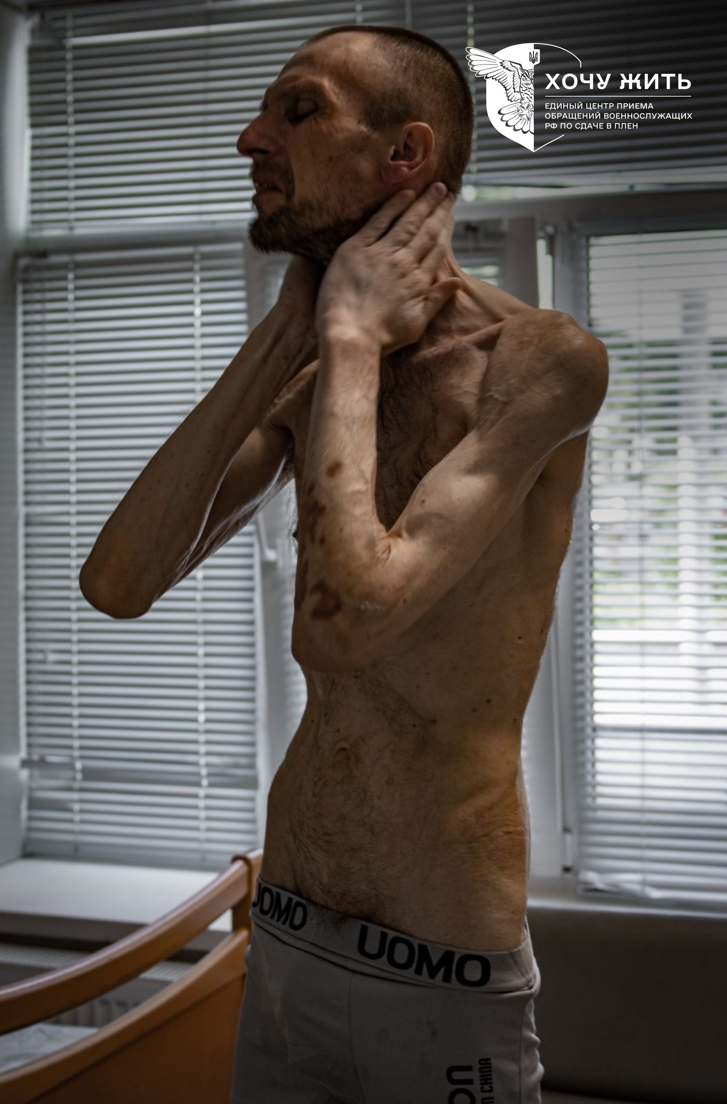 Wie KZ-Häftling: Bilder zeigen Ukrainer nach Haft in Putin-Gulag