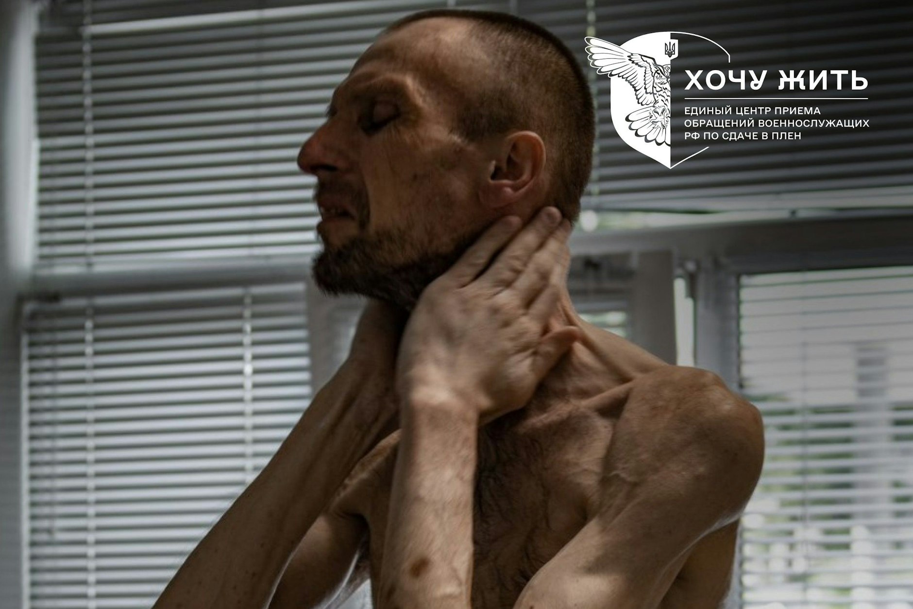 Der freigelassene Roman Gorilyk ist in der russischen Gefangenschaft deutlich abgemagert. Manche fühlen sich an die Bilder von KZ-Häftlingen im Dritten Reich erinnert.