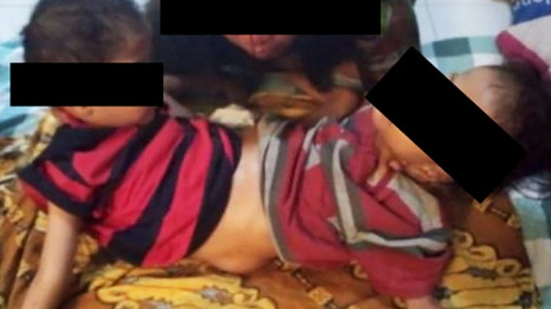 Nach der Operation sind die Kinder bereits in der Lage, sich aufzurichten - vielleicht können sie irgendwann sitzen oder sogar stehen.
