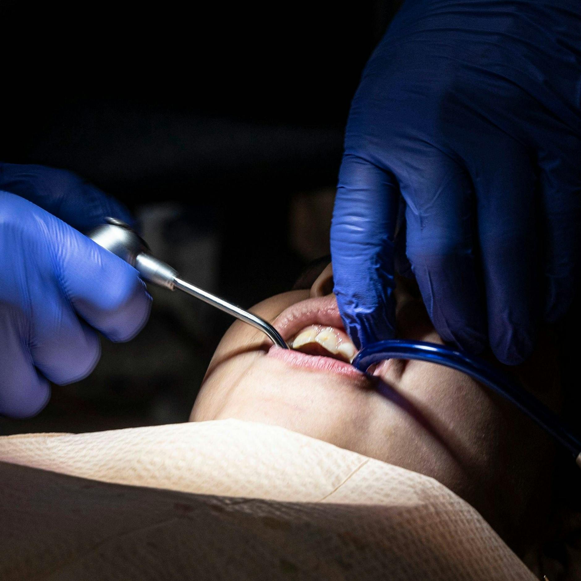 Image - Giftige Gefahr: Amalgam-Plomben sind gefährlich, sie zu entfernen ist noch gefährlicher