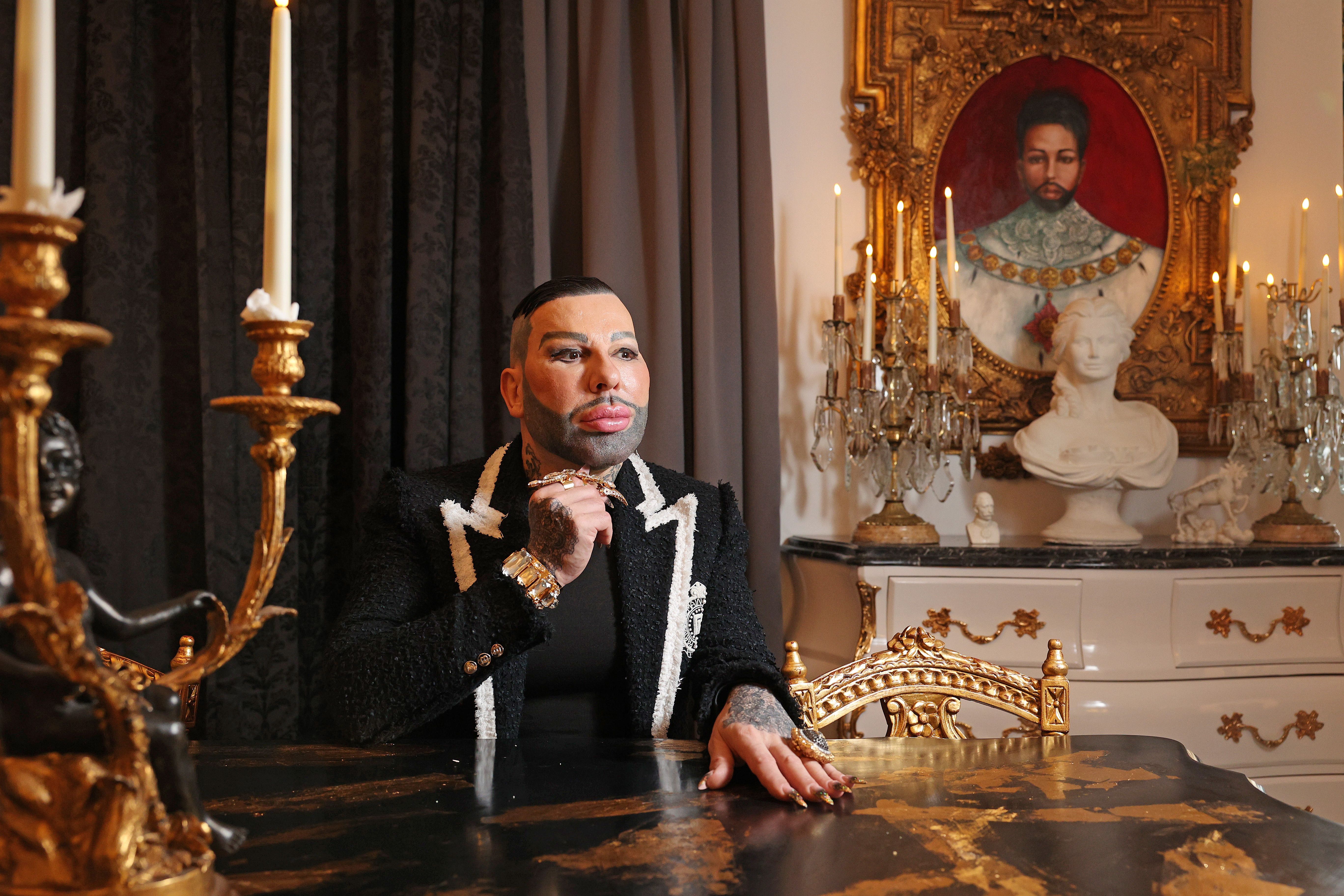 Krasse Summe! Harald Glööckler verrät: So viel hat sein Körper gekostet