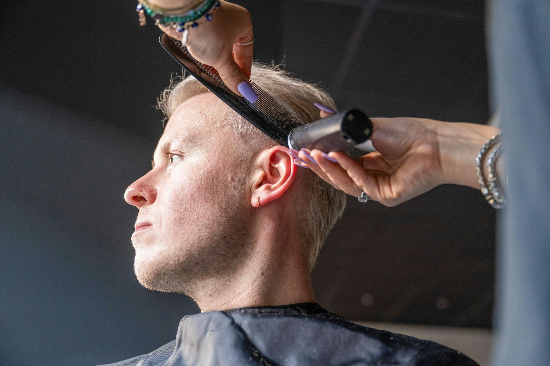 Aktuell sorgt ein neuer Krankheitserreger für besorgte Gesichter: Trichophyton tonsurans, ein Pilz, der vor allem bei jungen Männern und Jugendlichen für schuppende und teils eitrige Infektionen auf Kopf und im Bartbereich sorgt.