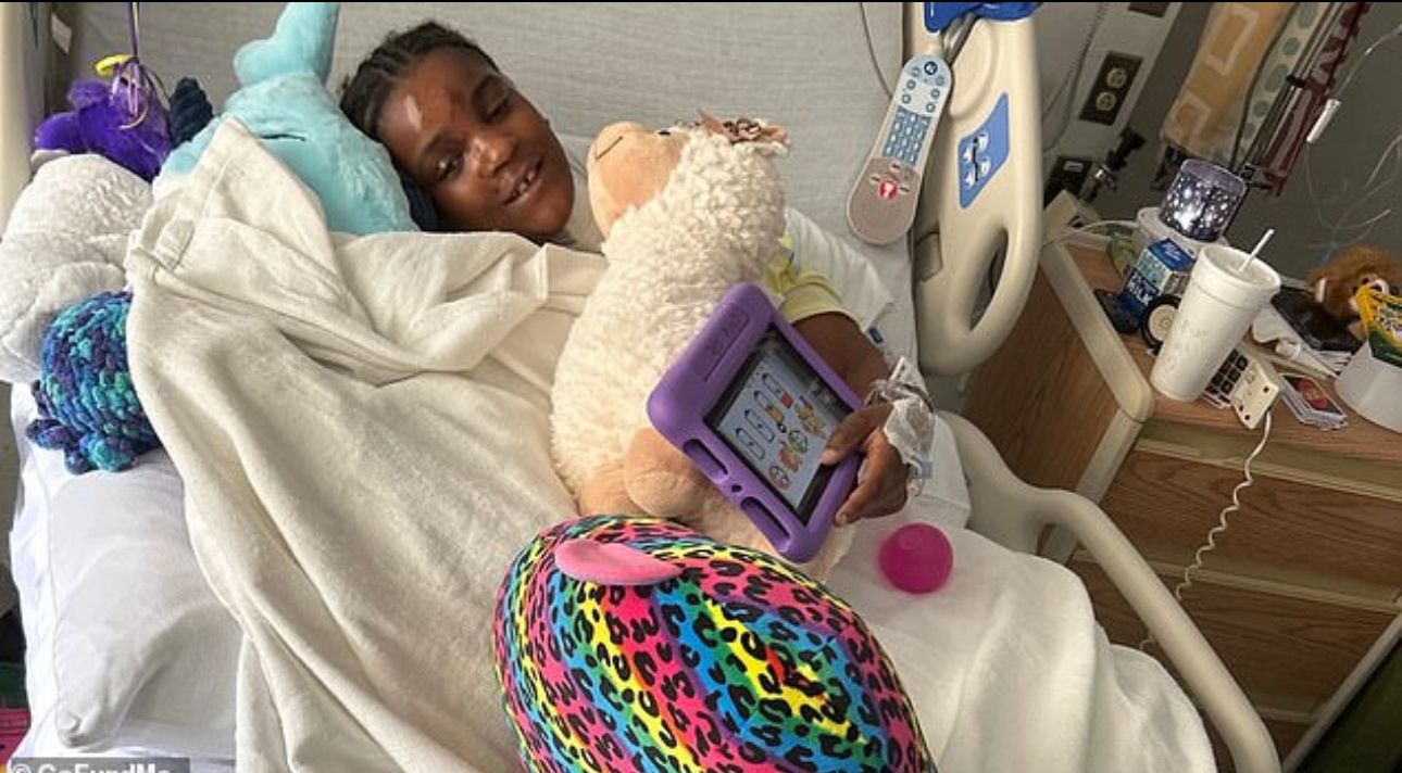 Image - Elfjährige verliert Hand, weil sie Dynamitstange für Wunderkerze hält