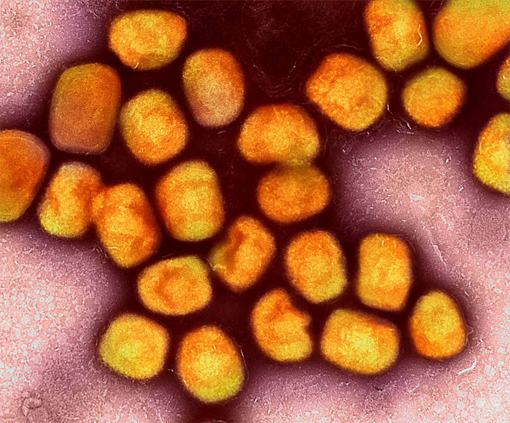 Mehr als 900 Mpox-Fälle im Juni: WHO-Ausschuss berät über mögliche Notlage
