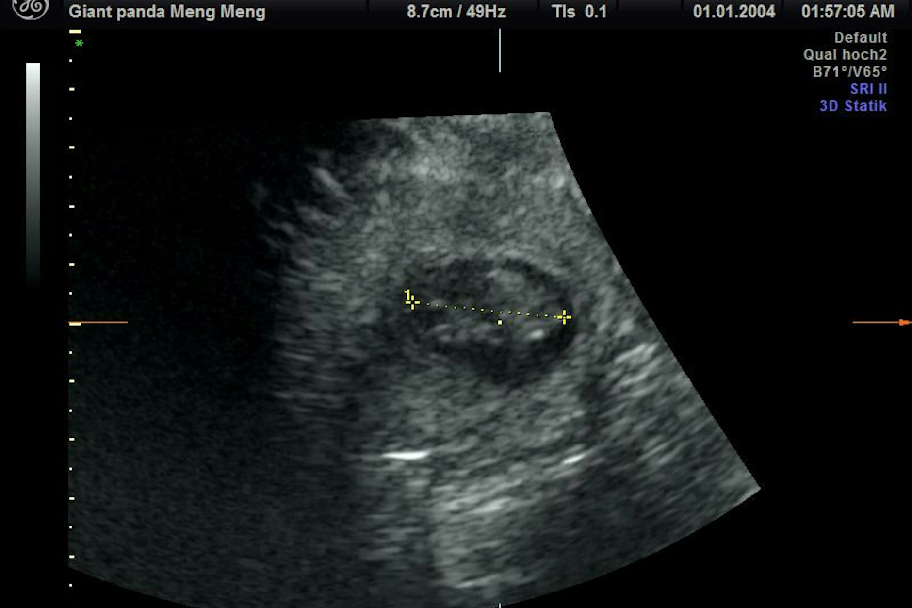 Die Ultraschallaufnahme bei Panda-Dame Meng Meng zeigt den zu erwartenden Nachwuchs. 