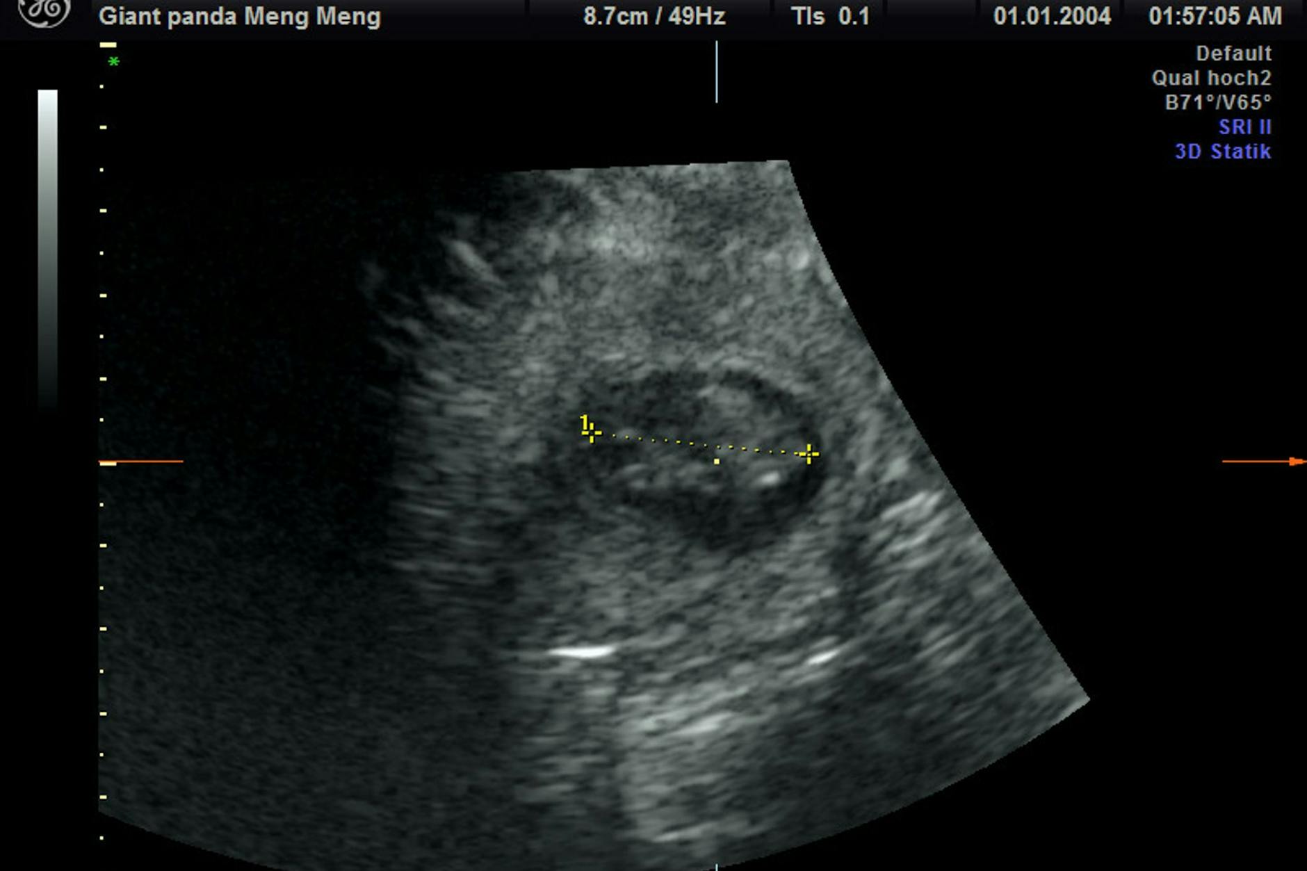 Die Ultraschallaufnahme bei Panda-Dame Meng Meng zeigt den zu erwartenden Nachwuchs. 