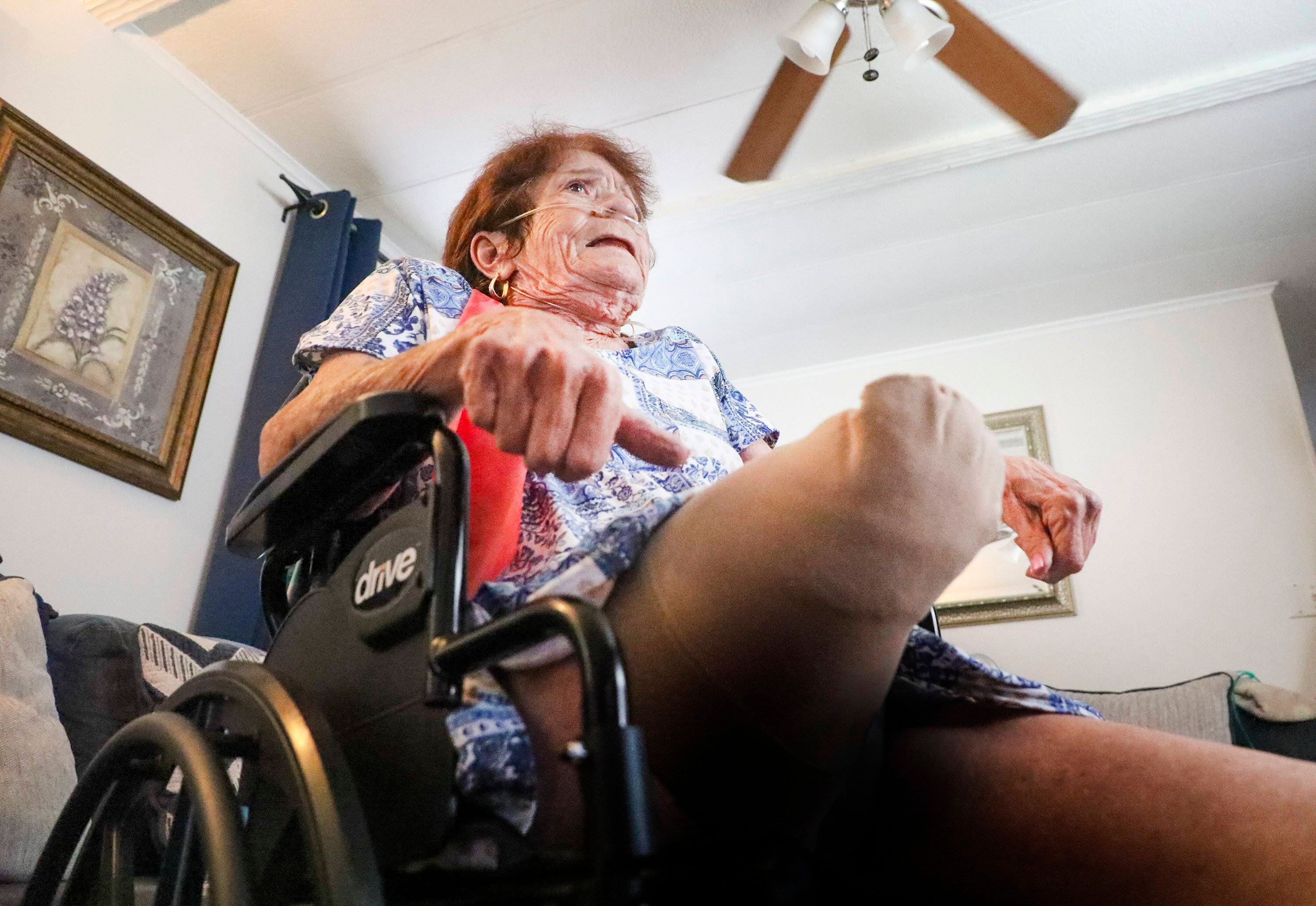 Gefährliche Vibrionen: Debbie (72) infizierte sich – und verlor ihr Bein!