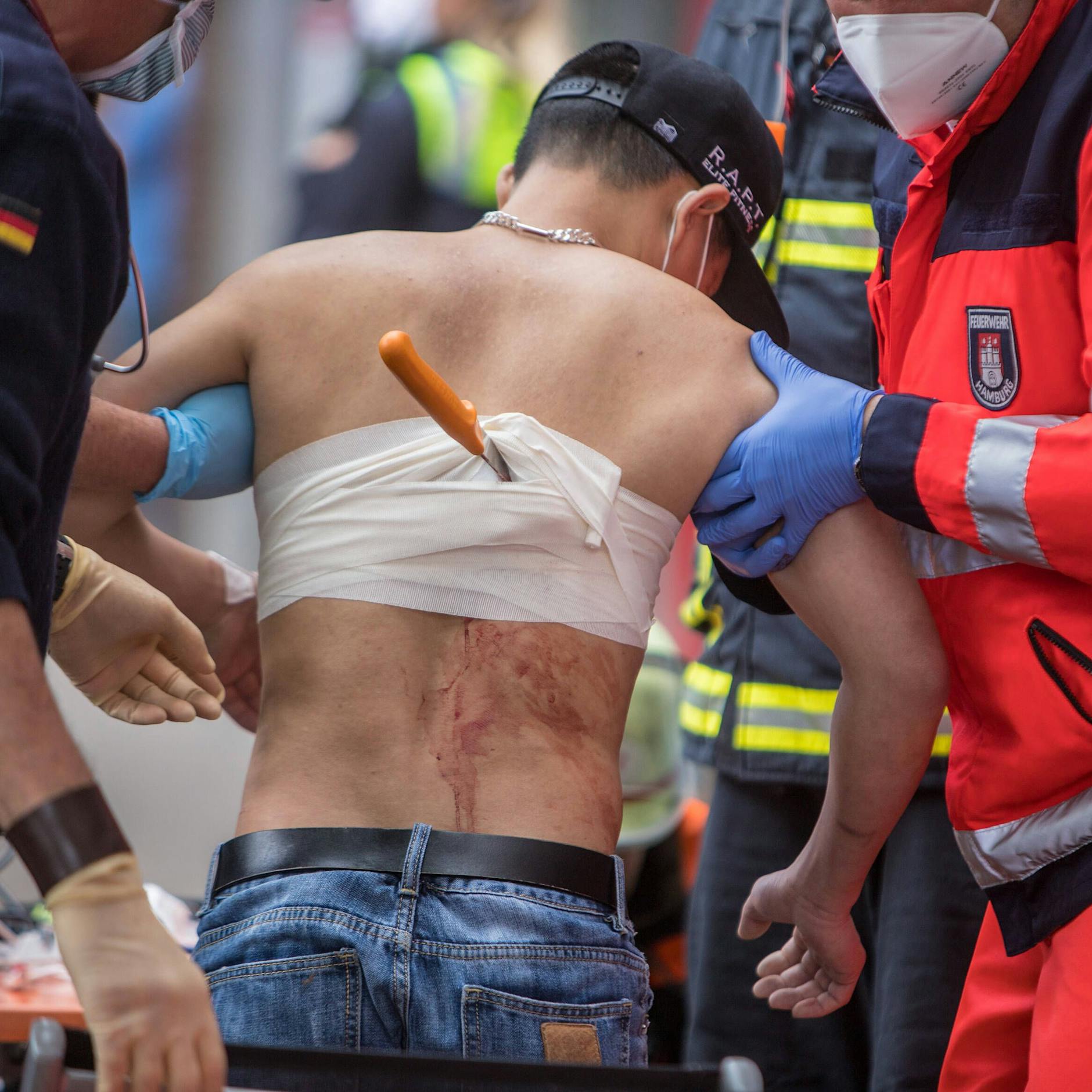 Intensivpfleger über Messer-Attacken: Das ganze Gesicht war aufgeschnitten!