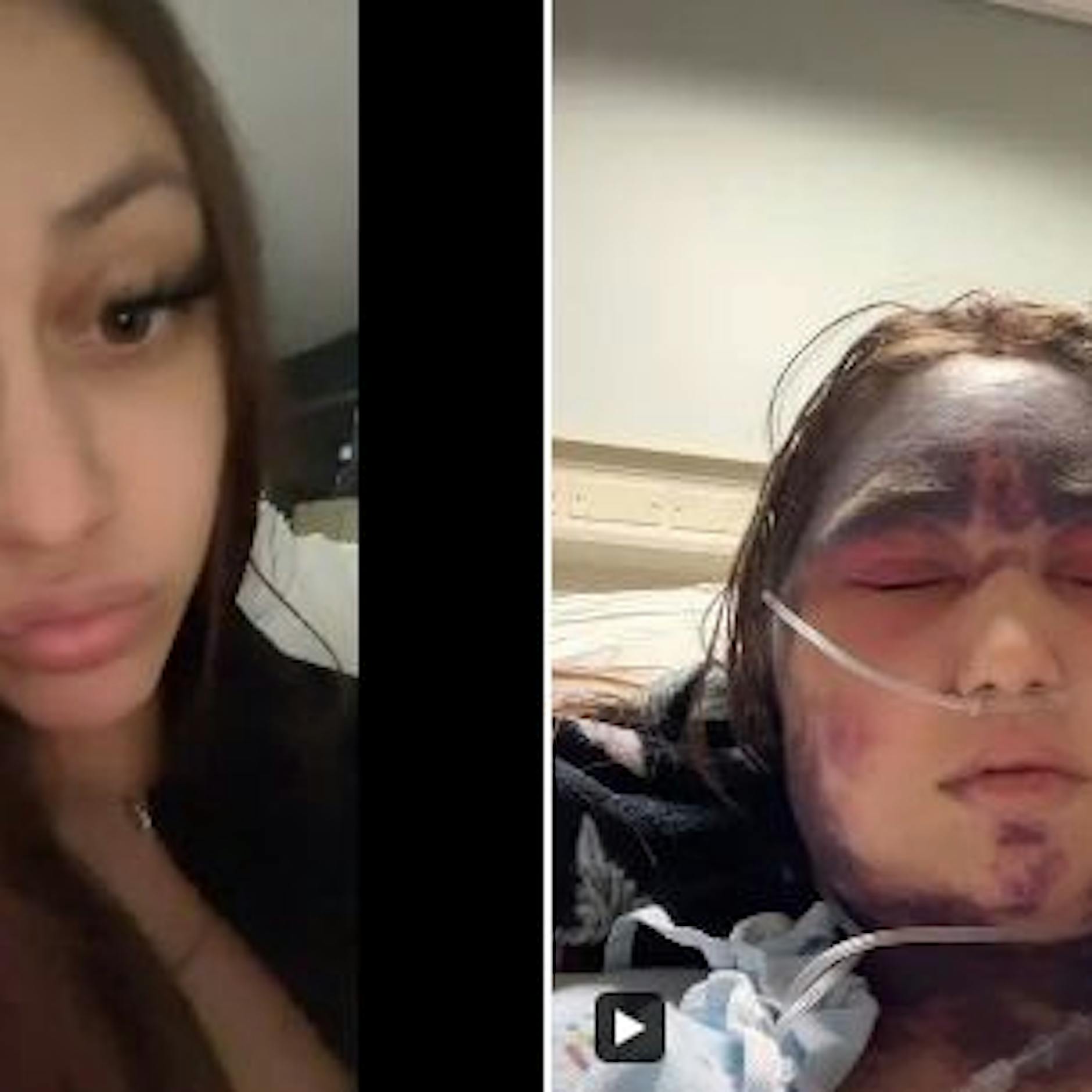 Hilfeschrei auf TikTok von Alexis Lorenze: Hat eine Impfung diese Frau so zugerichtet?