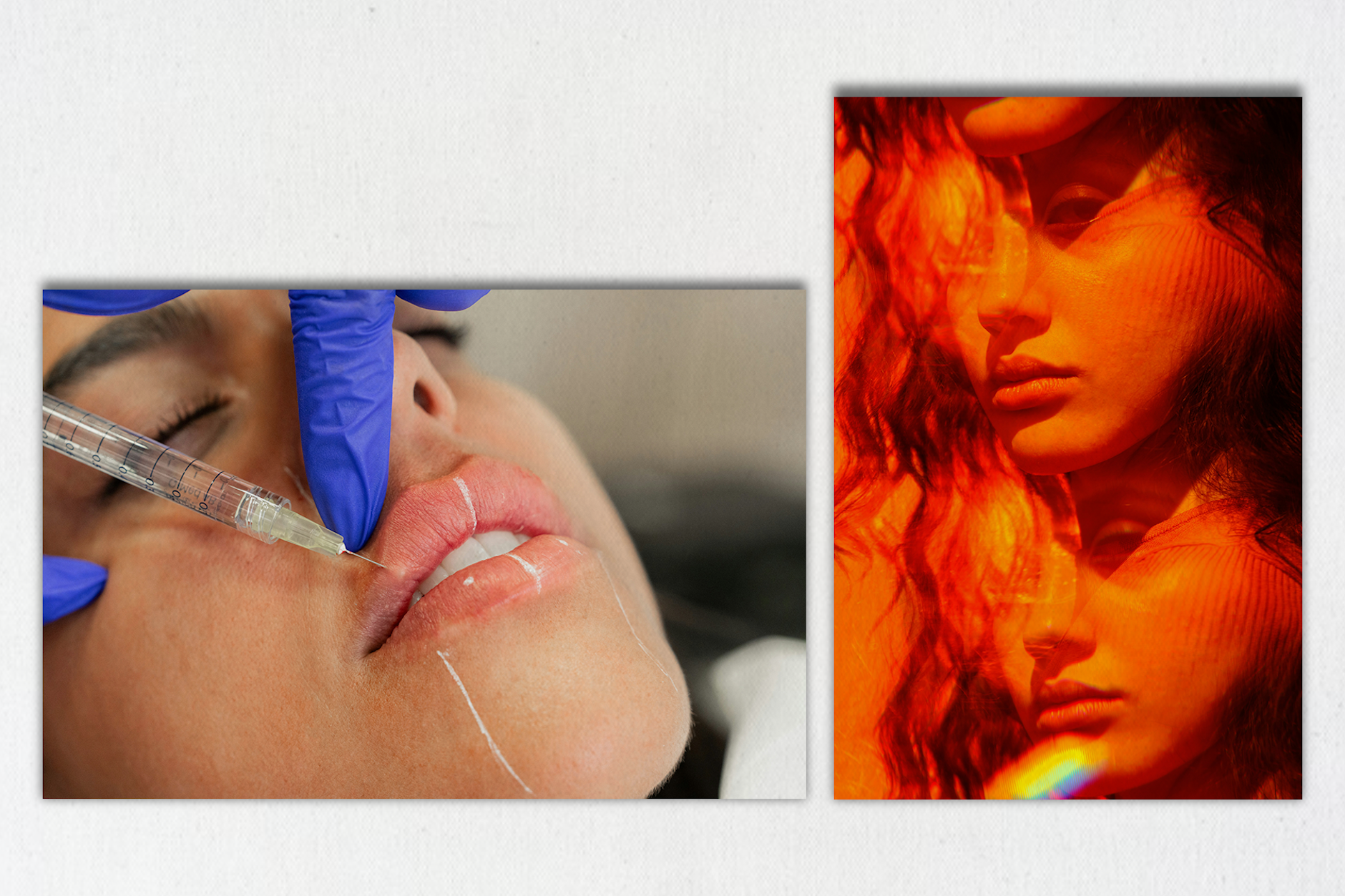 Bei Fillern geht es um Maß und Proportion.