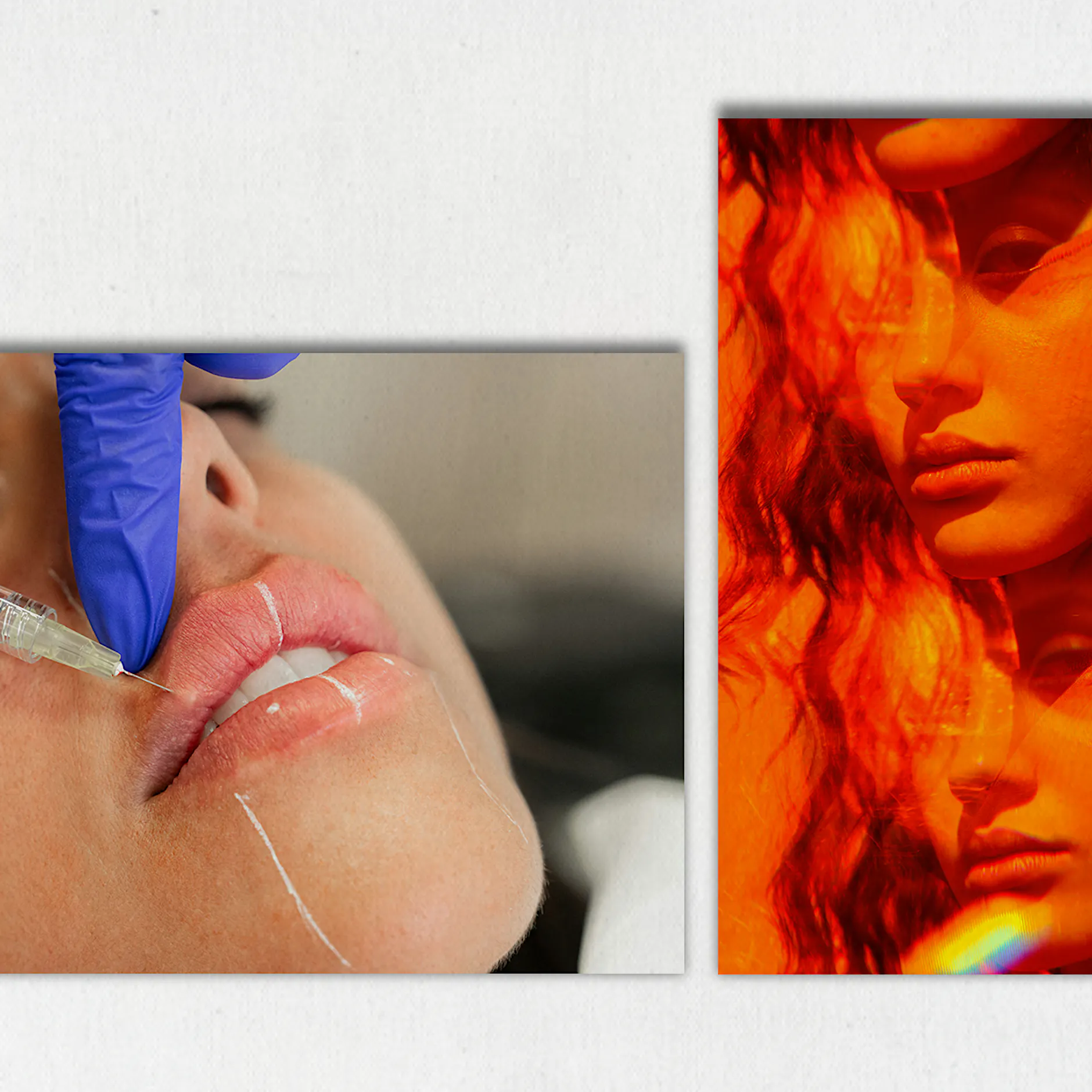 Plastischer Chirurg aus Berlin: „Dieter Bohlen sieht schrecklich aus“