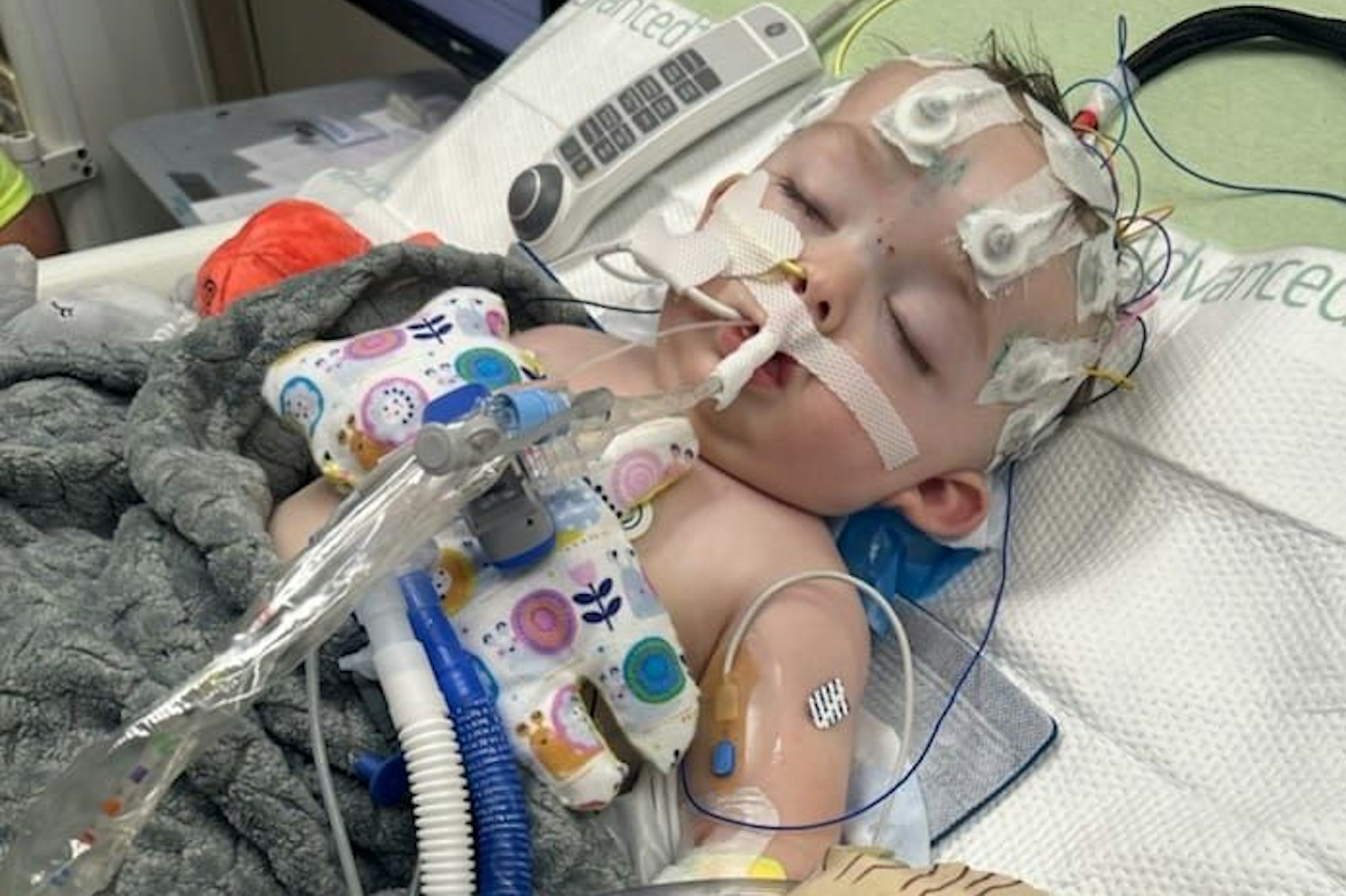 Der kleine Waylon ist gerade neun Monate alt – und muss im Krankenhaus um sein Leben kämpfen.