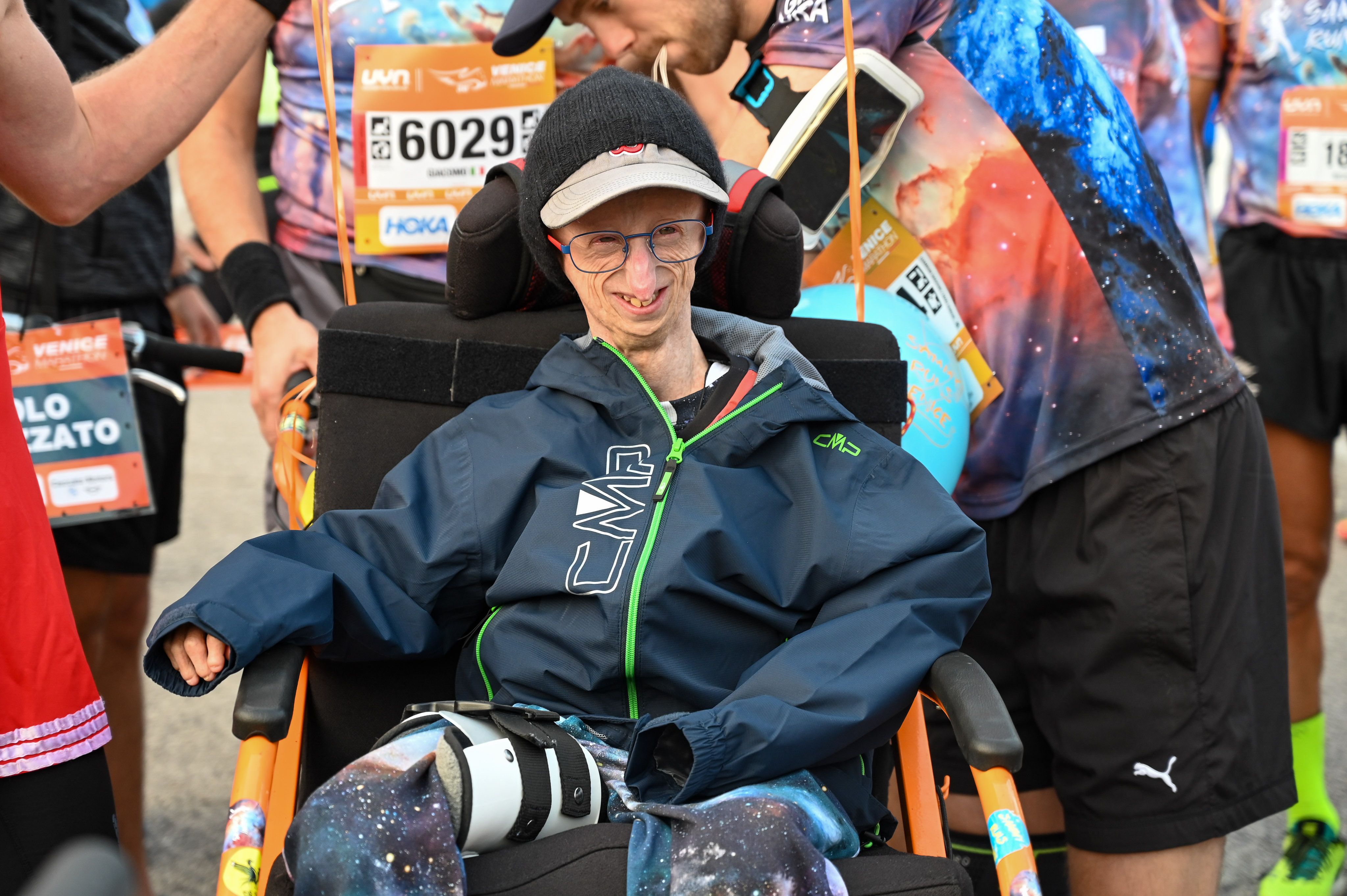 Image - Sammy Basso stirbt mit 28 Jahren als ältester Mensch mit Progerie