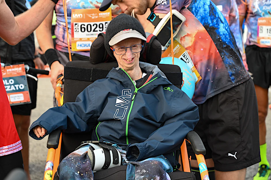 Der an Progerie leidende Sammy Basso widmete sich sein ganzes Leben lang seiner Erkrankung und deren Forschung.