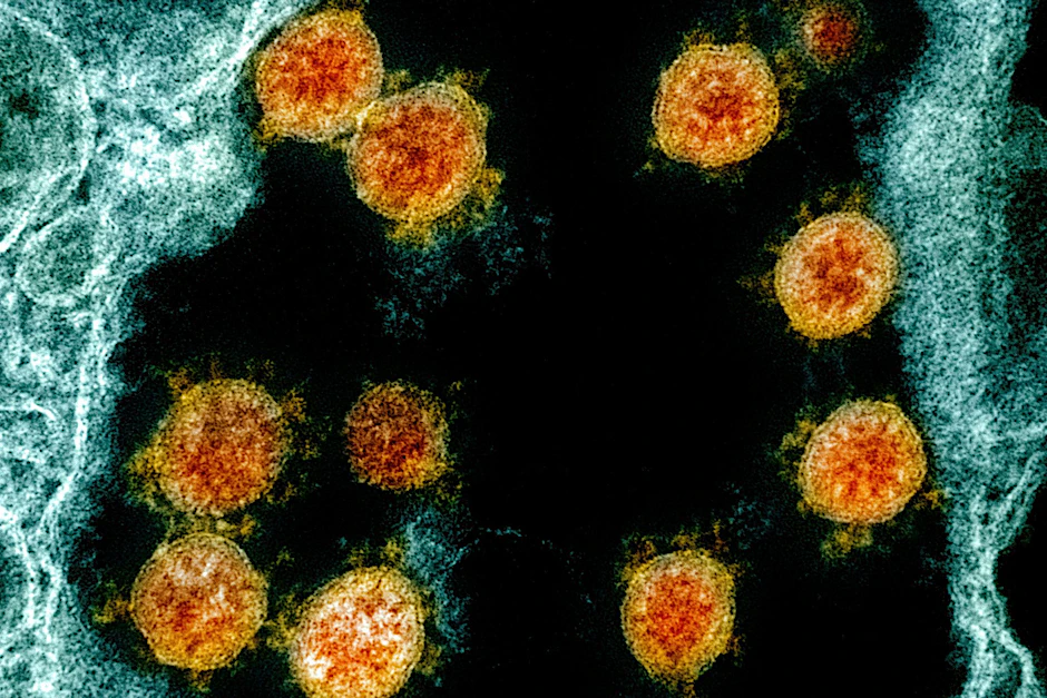 Elektronenmikroskopische Aufnahme des Coronavirus SARS-CoV-2.