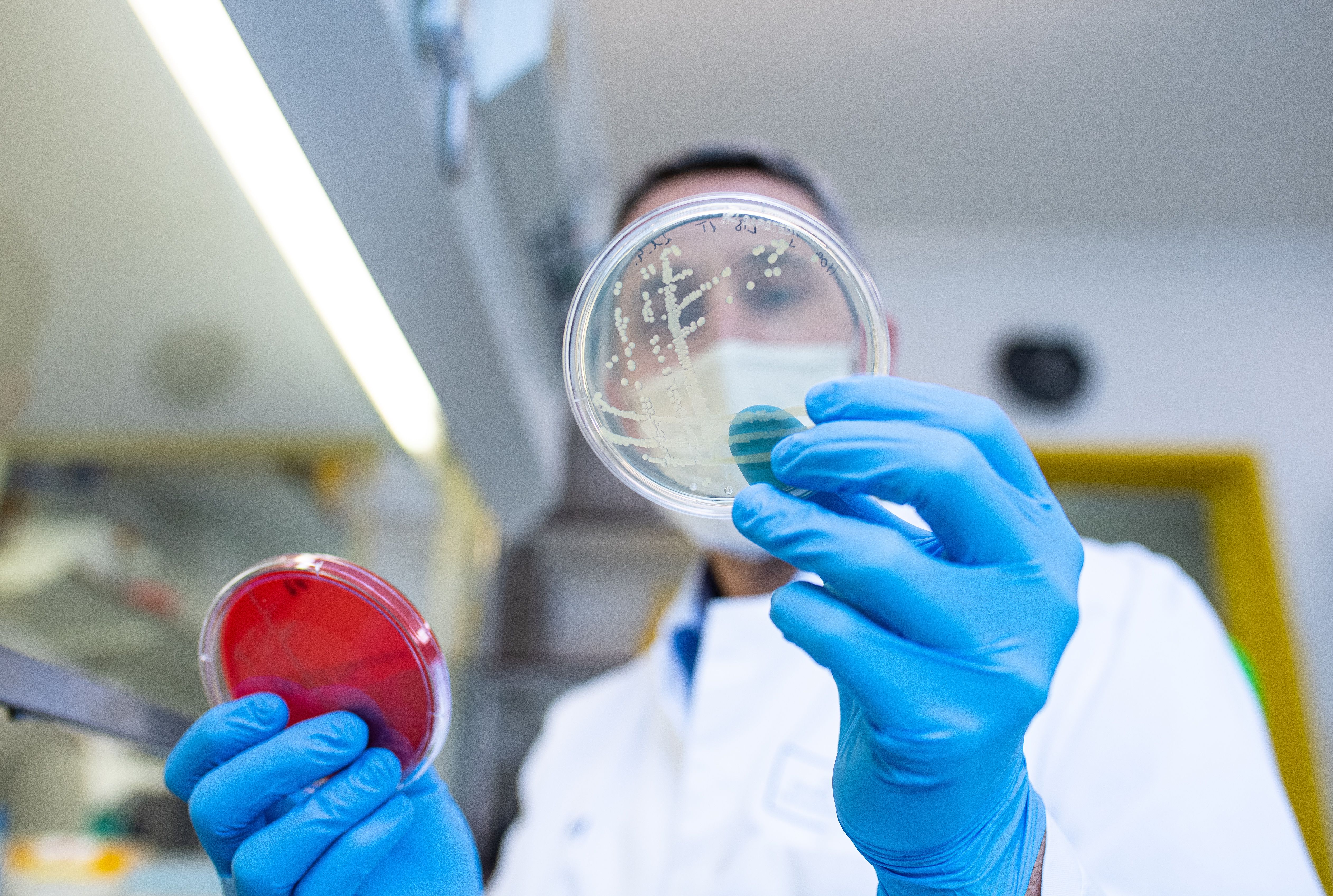 Gefährliche Darmseuche zurück – schon 127 Fälle in Berlin!